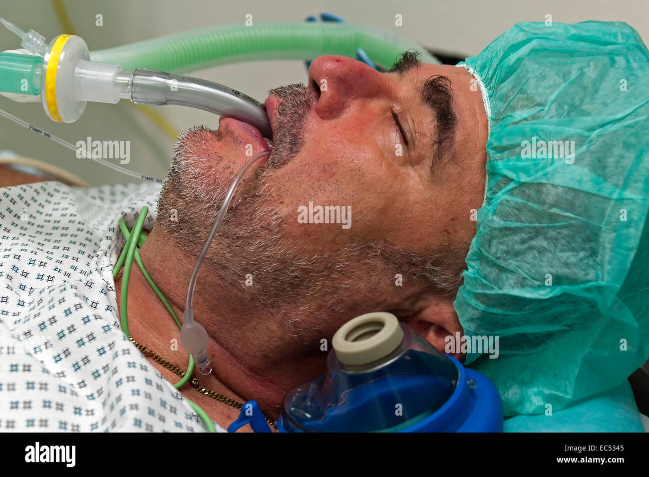 Il paziente è sotto anestesia generale e ventilati meccanicamente con una maschera laringea Foto Stock