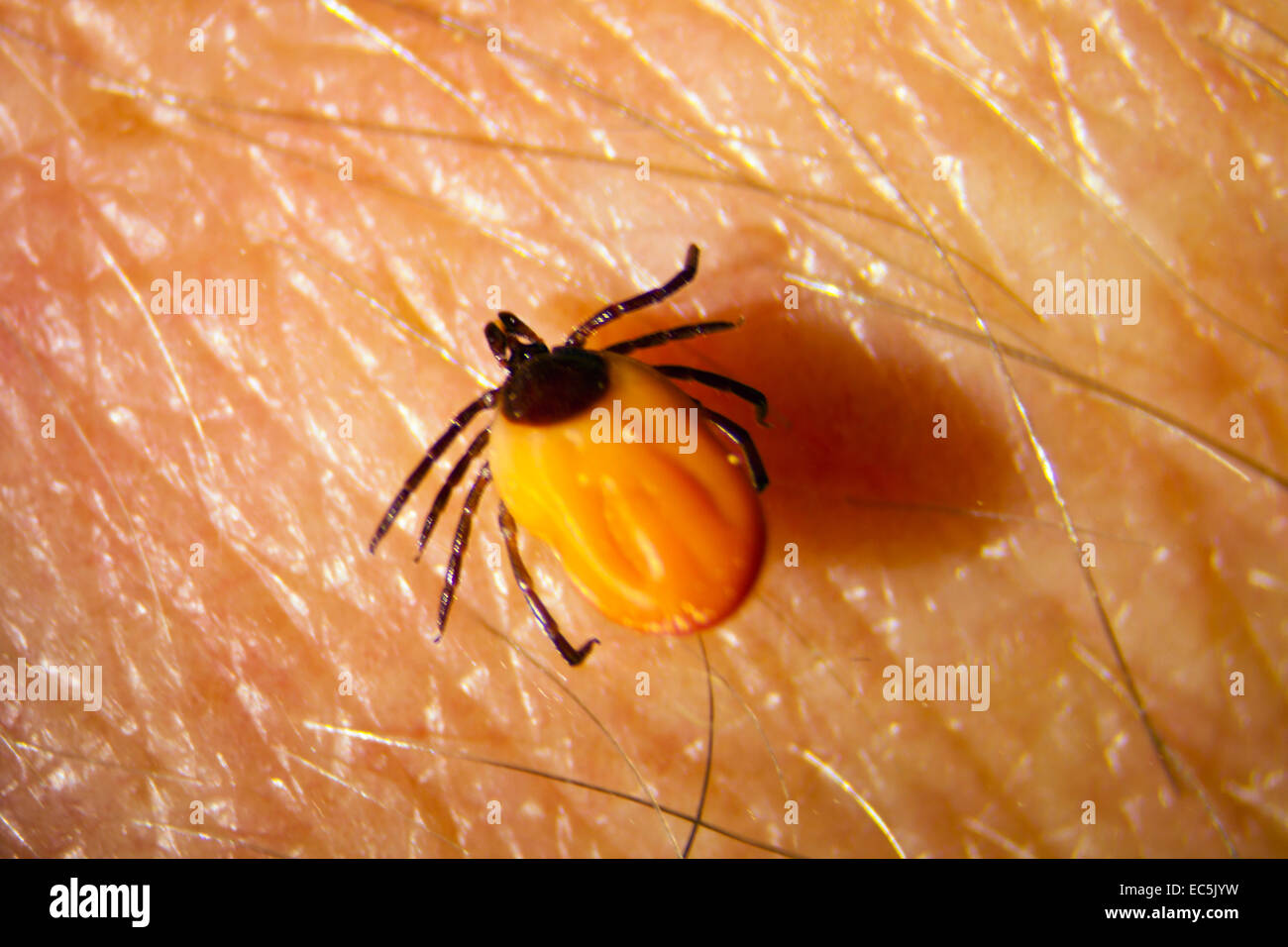 Tick Ixodes ricinus Foto Stock