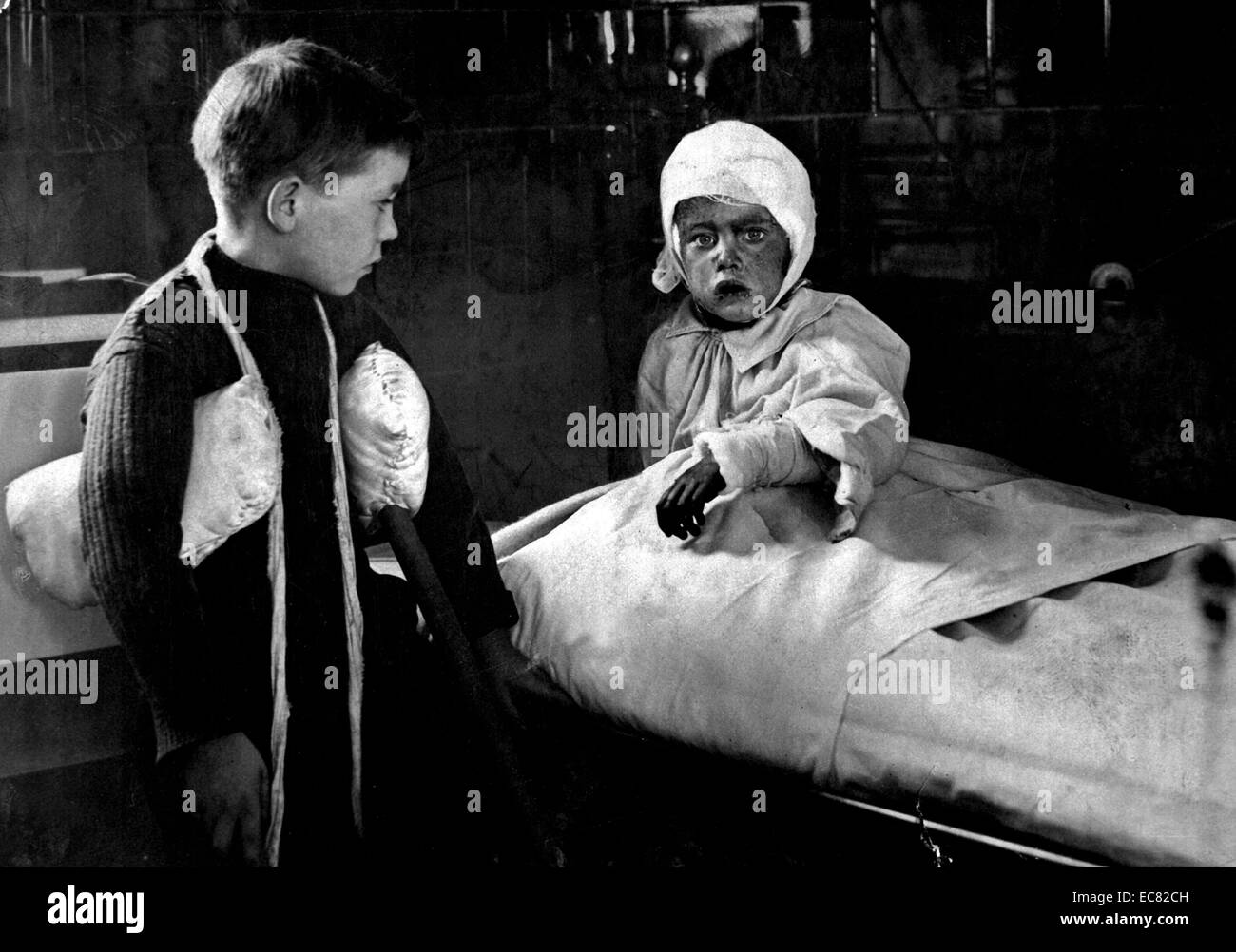 I bambini che ricevono il trattamento in ospedale. Le loro ferite causate da Zeppelin Air Raid le bombe su Londra, durante la Prima Guerra Mondiale, 1915. Foto Stock