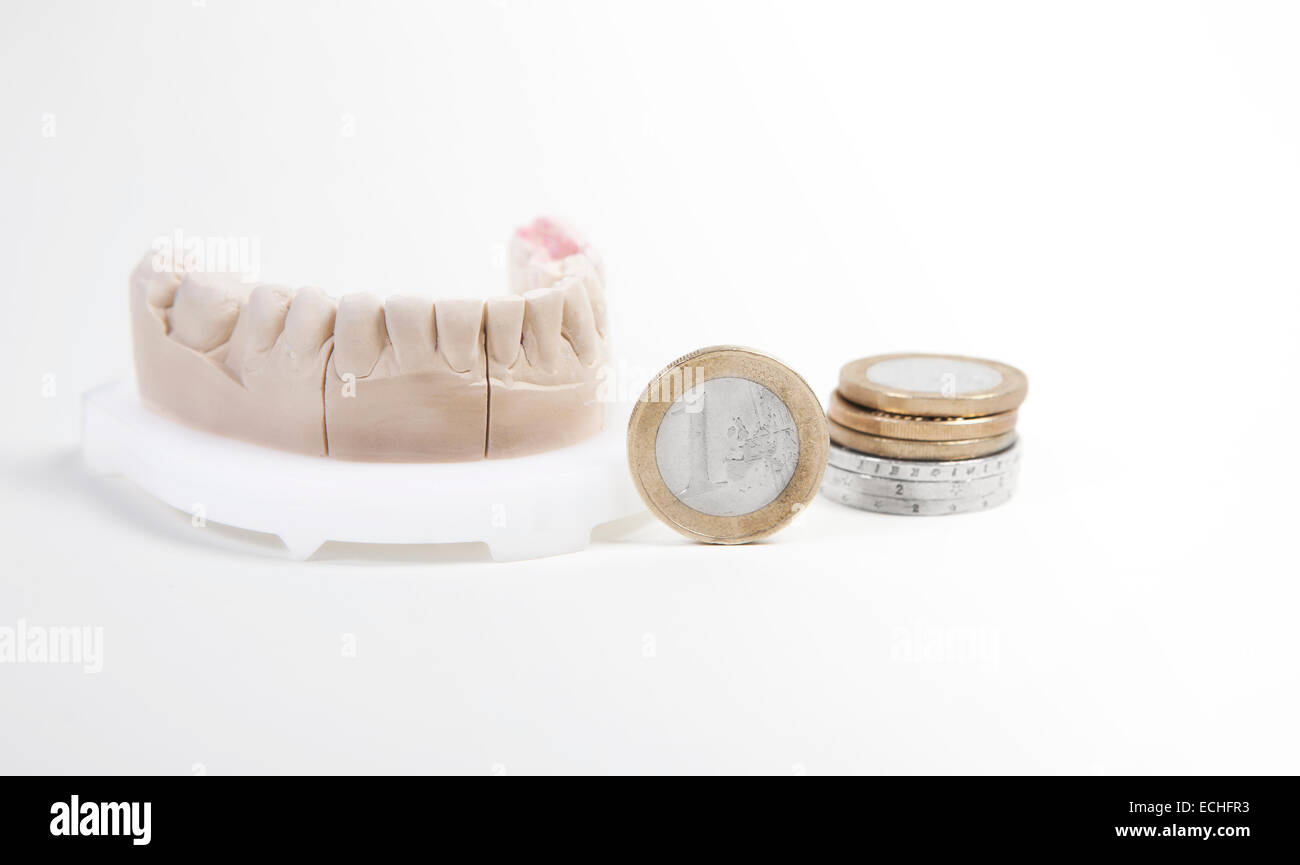 Una serie di denti per la produzione di una protesi dentale, prima che venga il denaro Foto Stock