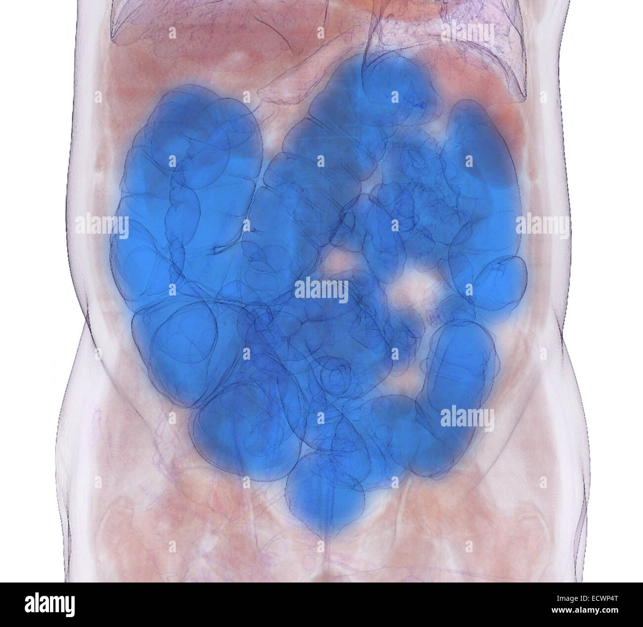 3D CT scan immagine di un CT la colonografia mediante procedura. Foto Stock
