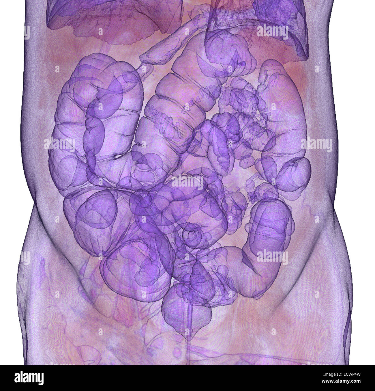 3D CT scan immagine di un CT la colonografia mediante procedura. Foto Stock