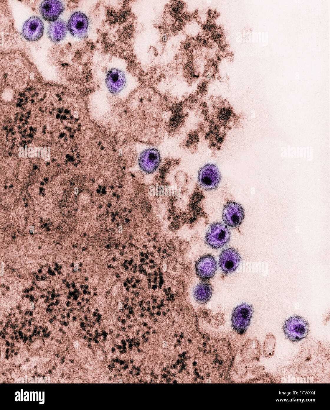 Micrografia elettronica di virus di immunodeficienza umana HIV. Foto Stock