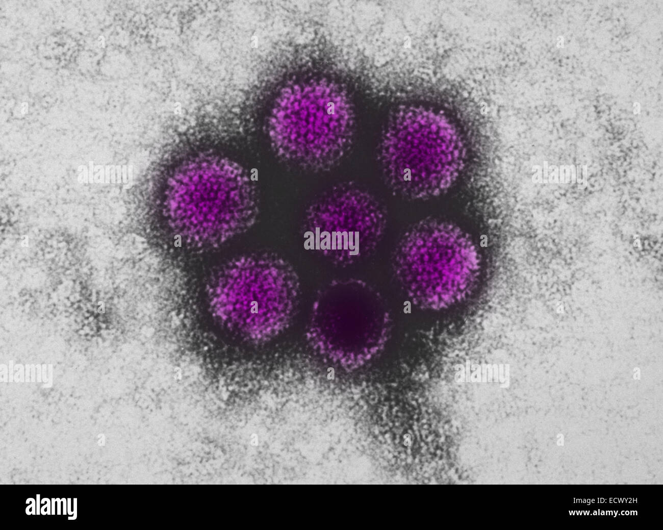 Micrografia elettronica di adenovirus canino tipo-1 (CAV-1). Foto Stock