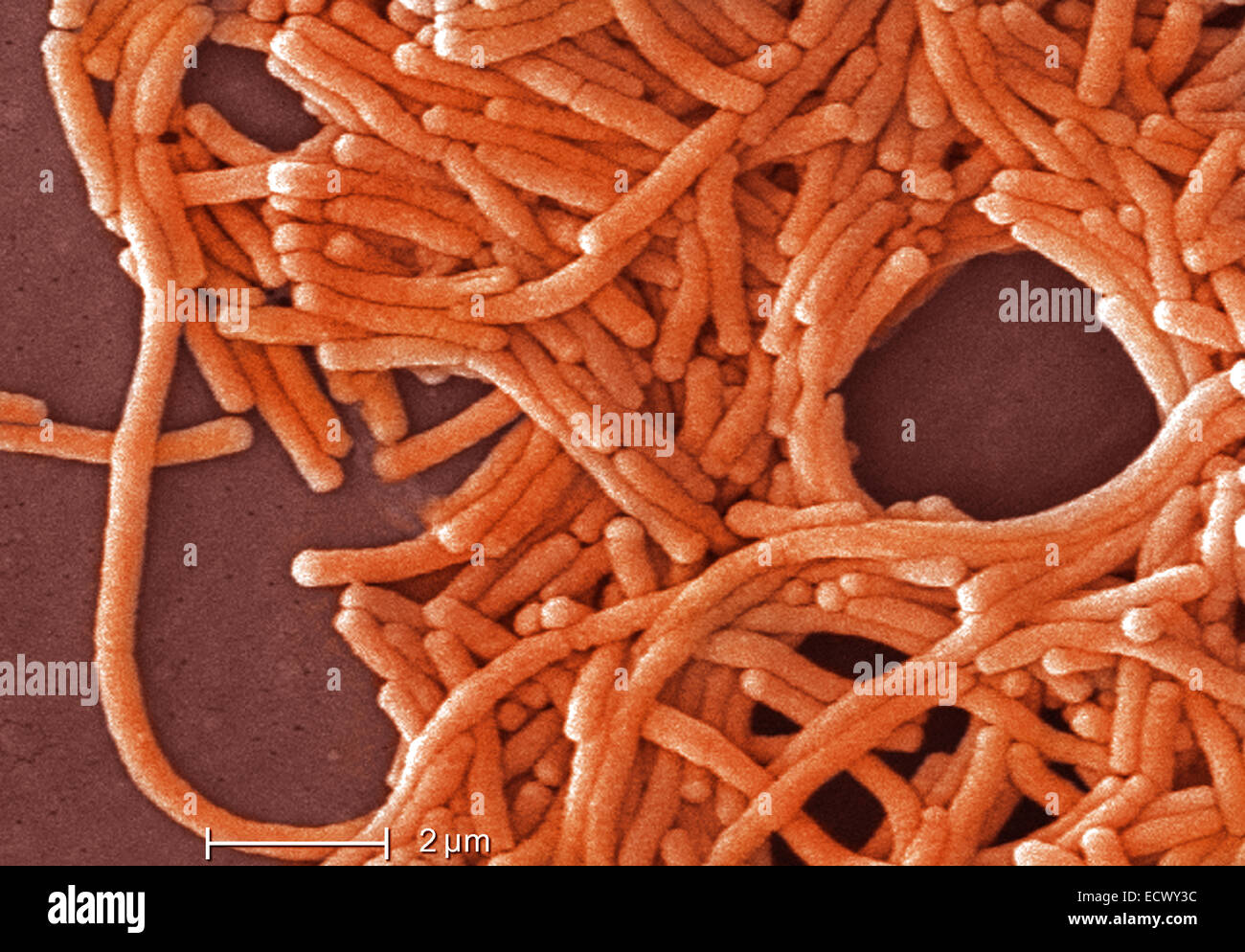 Micrografia elettronica a scansione della Legionella. Foto Stock