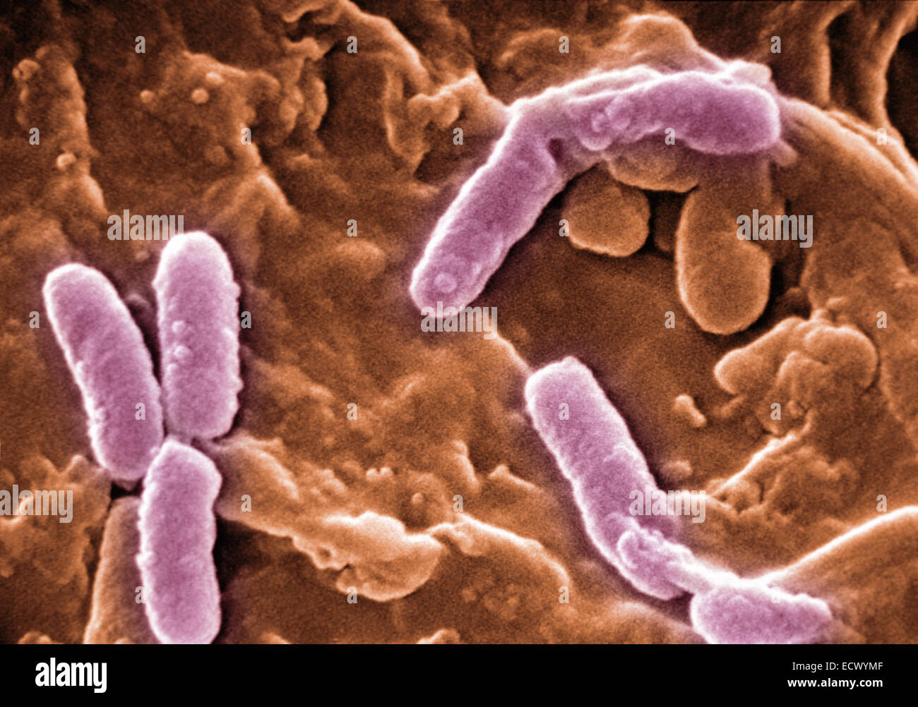 Micrografia elettronica a scansione di Pseudomonas aeruginosa. Foto Stock