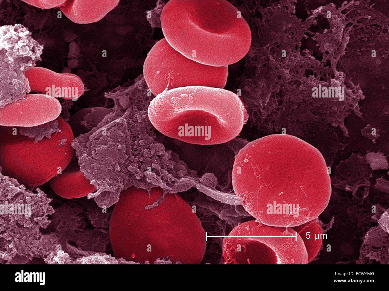 Micrografia al microscopio elettronico a scansione di cellule rosse del  sangue e fibrina Foto stock - Alamy