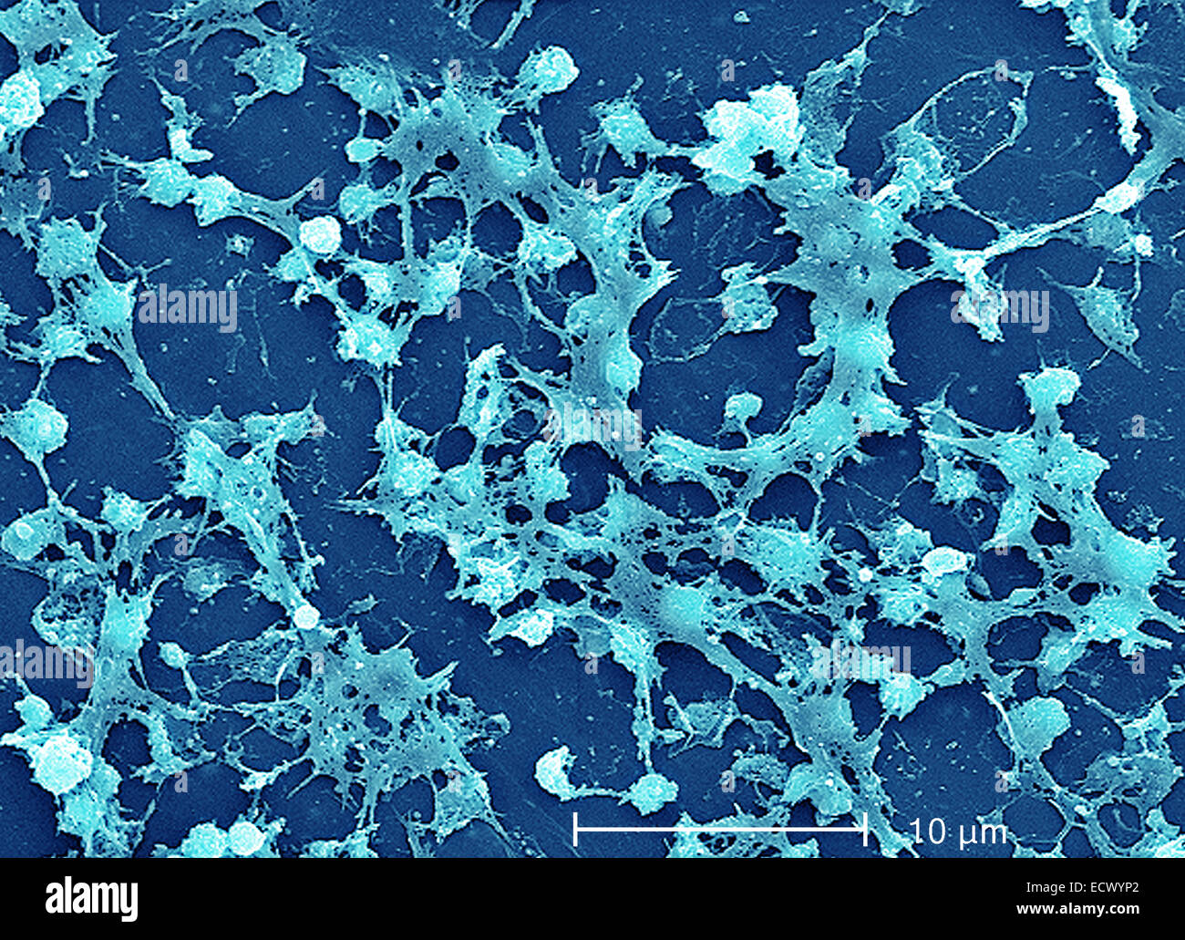 Electron microfotografia che mostra lo Staphylococcus aureus batteri. Foto Stock