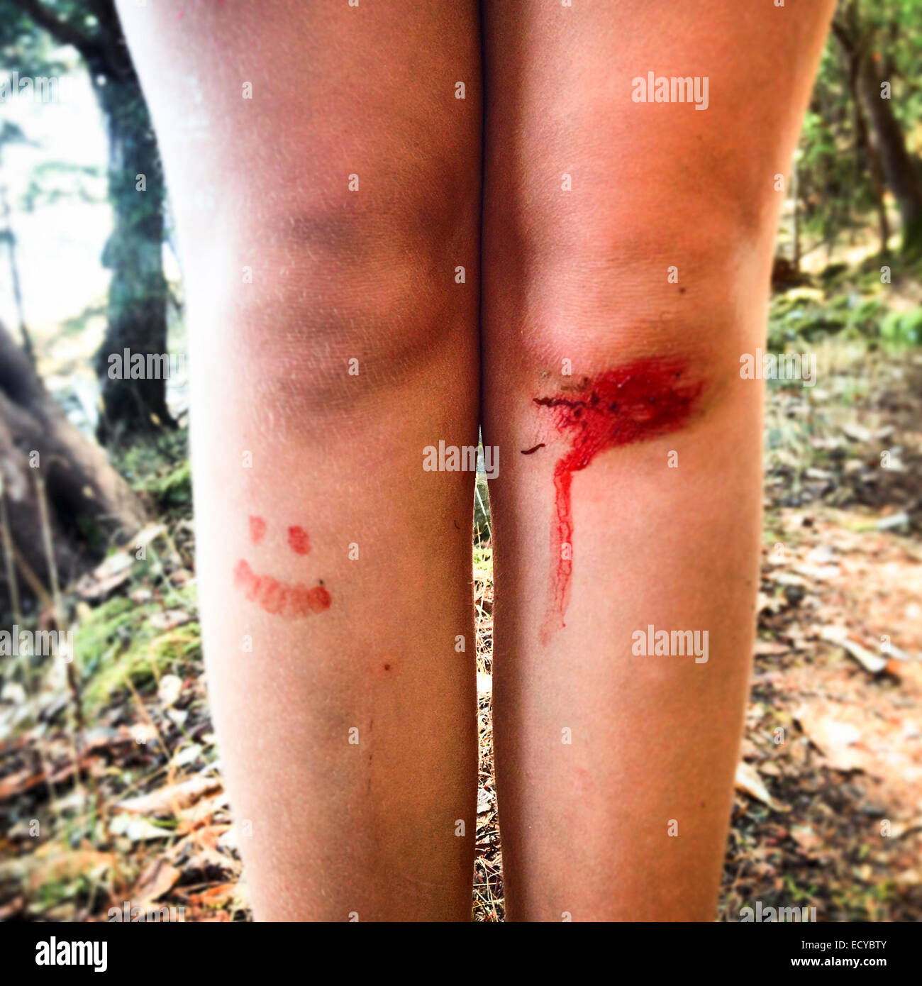 Close up di taglio ginocchio della ragazza con faccina sorridente disegnato nel sangue - Immagine stock catturata con smartphone