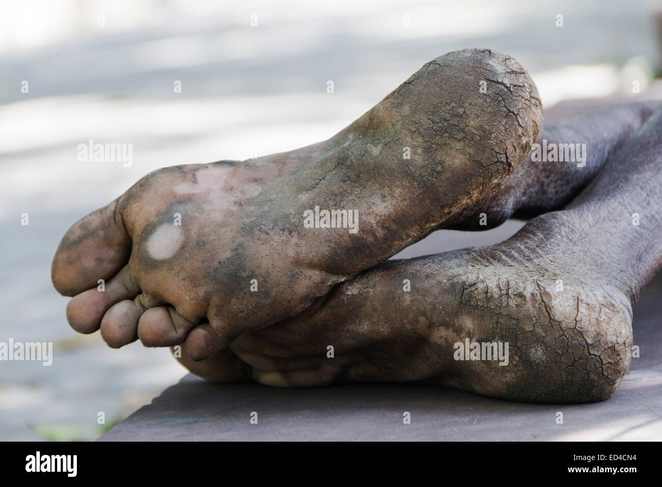 1 baraccopoli uomo piede sporco Foto Stock