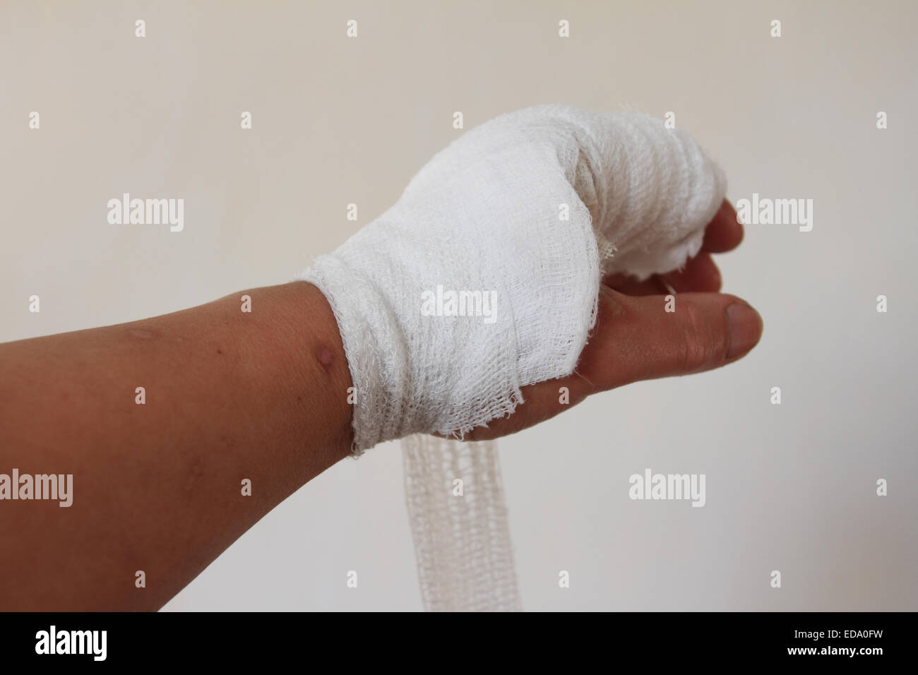 La mano sinistra maschile ha un incidente, la bendatura sulla mano sinistra, Norfolk, Regno Unito Foto Stock