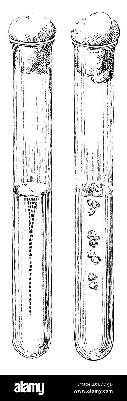 Bakterienkulturen im Reagenzglas, tifo, Tuberkulose Foto Stock