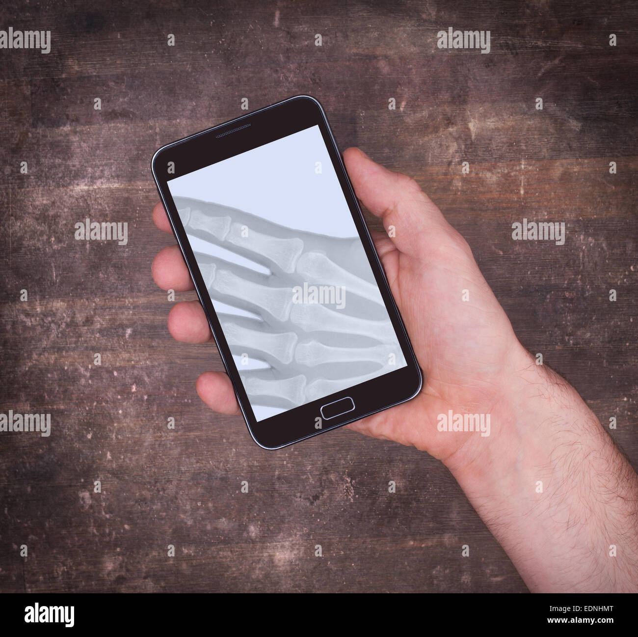 Il display dello smartphone che mostra un x-ray della mano tenendolo Foto Stock