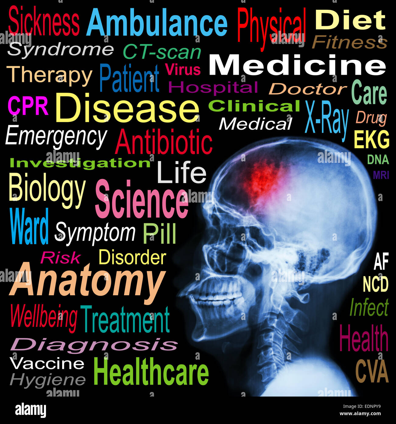 X-ray cranio e 'Stroke' e Medical word cloud Foto Stock