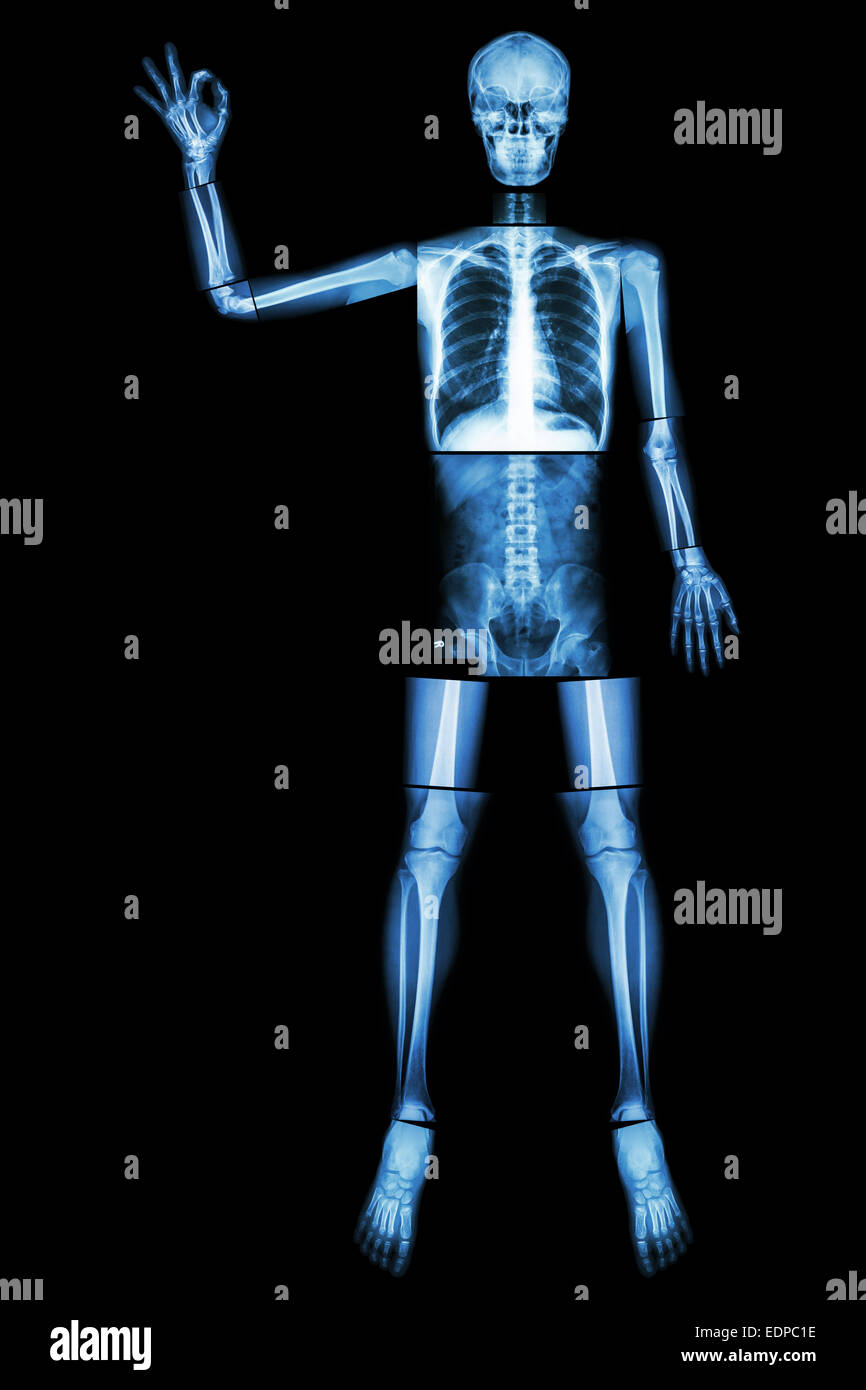 OK scheletro (osso umano alzare la mano e il segno OK) (corpo intero : collo capo colonna vertebrale spalla gomito del braccio avambraccio polso mano dito t Foto Stock