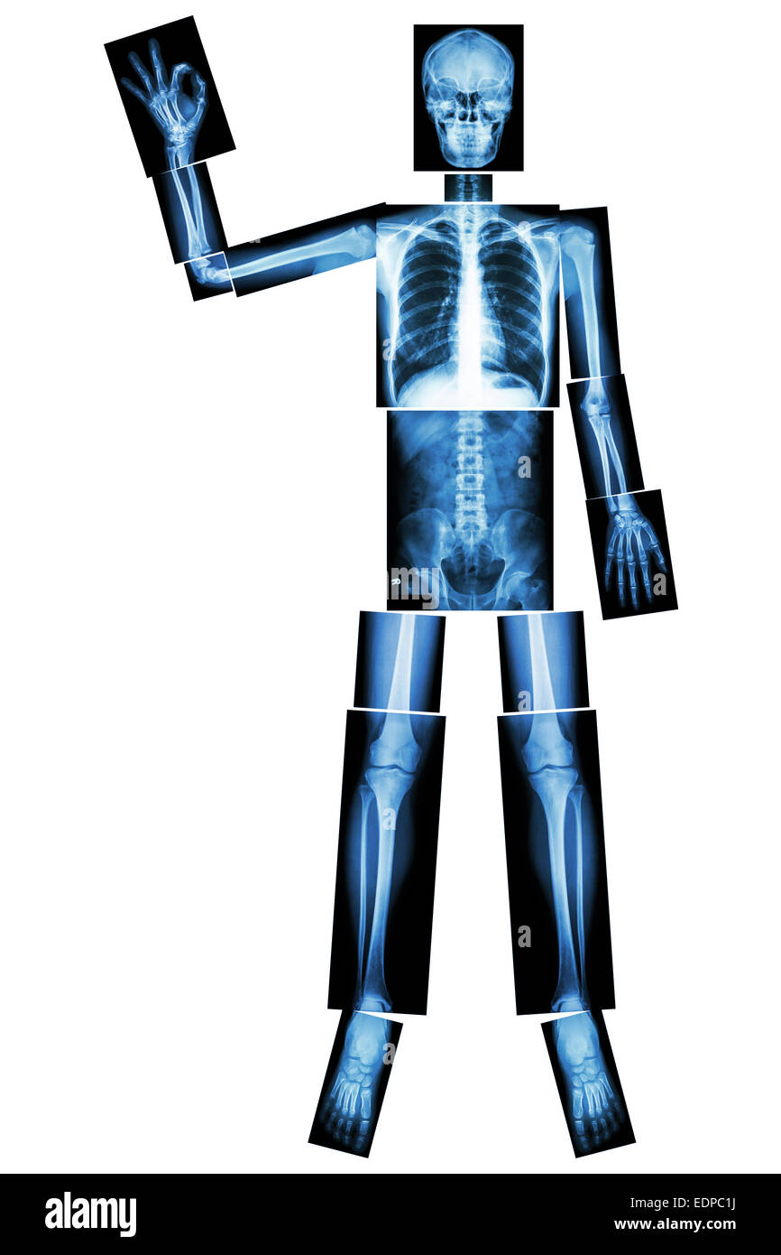 OK scheletro (osso umano alzare la mano e il segno OK) (corpo intero : collo capo colonna vertebrale spalla gomito del braccio avambraccio polso mano dito t Foto Stock