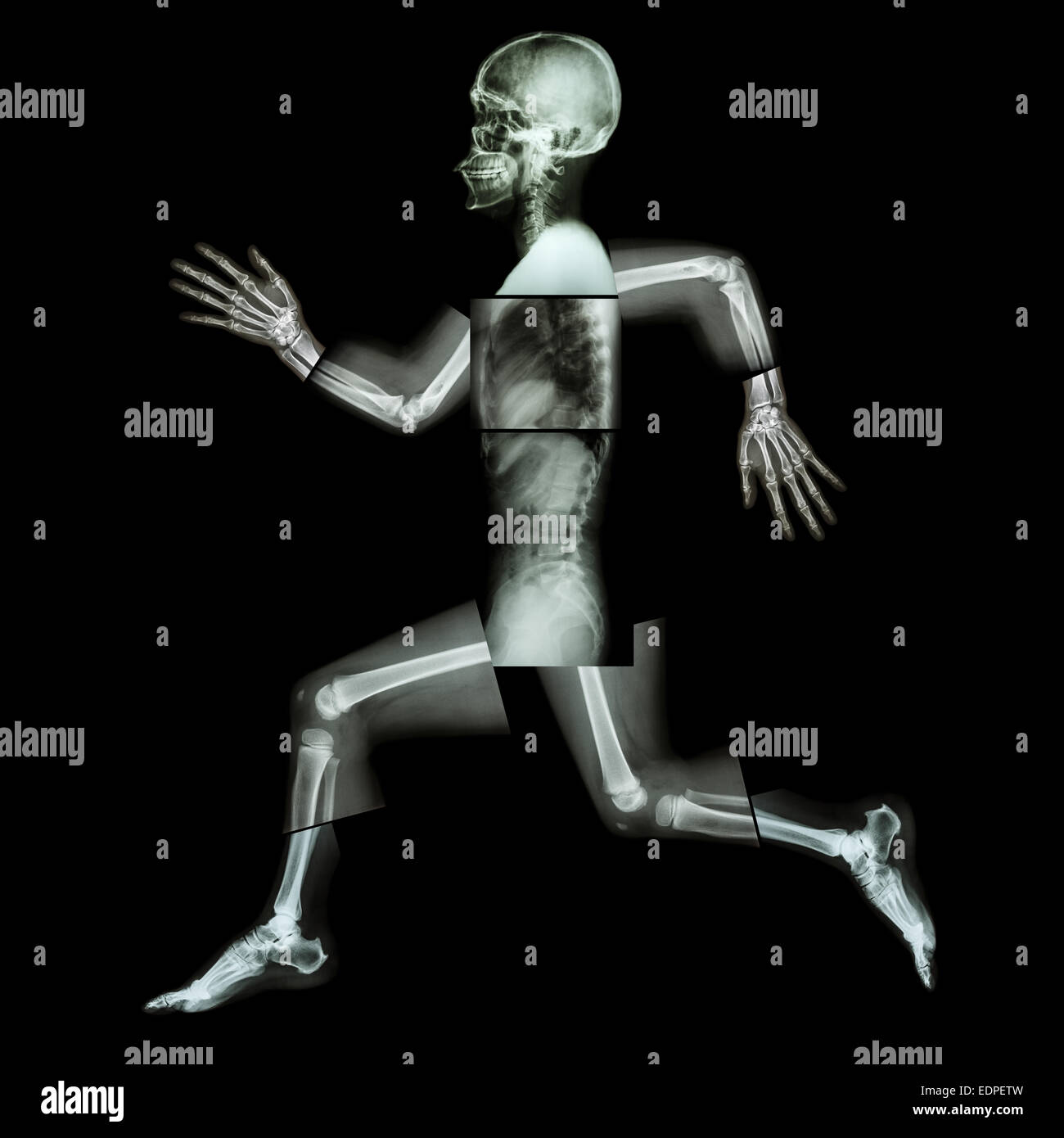 Esercizio aerobico (osso umano è acceso) ,(tutto il corpo x-ray : testa ,collo ,spalla Spalla ,,braccio ,il gomito ,avambraccio ,mano ,dito Foto Stock