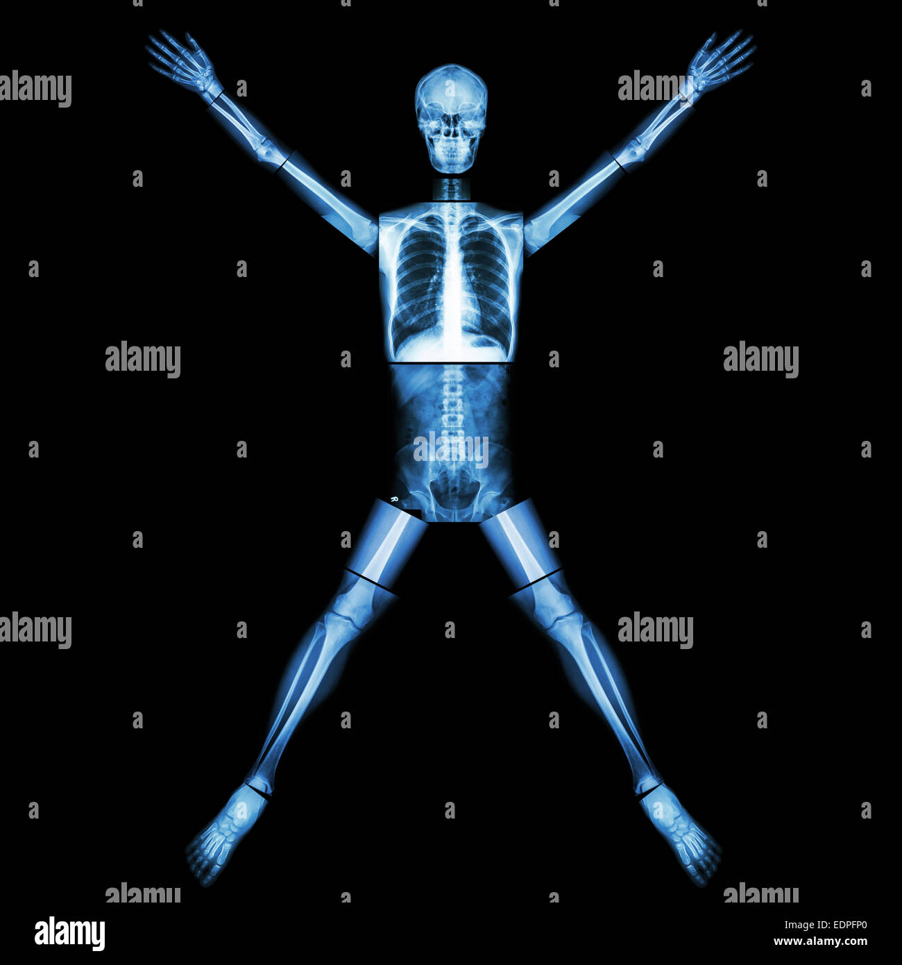 Un osso umano si allunga la gamba e il braccio (corpo intero : collo capo dorso posteriore torace addome spalla gomito del braccio avambraccio mano polmone da polso Foto Stock
