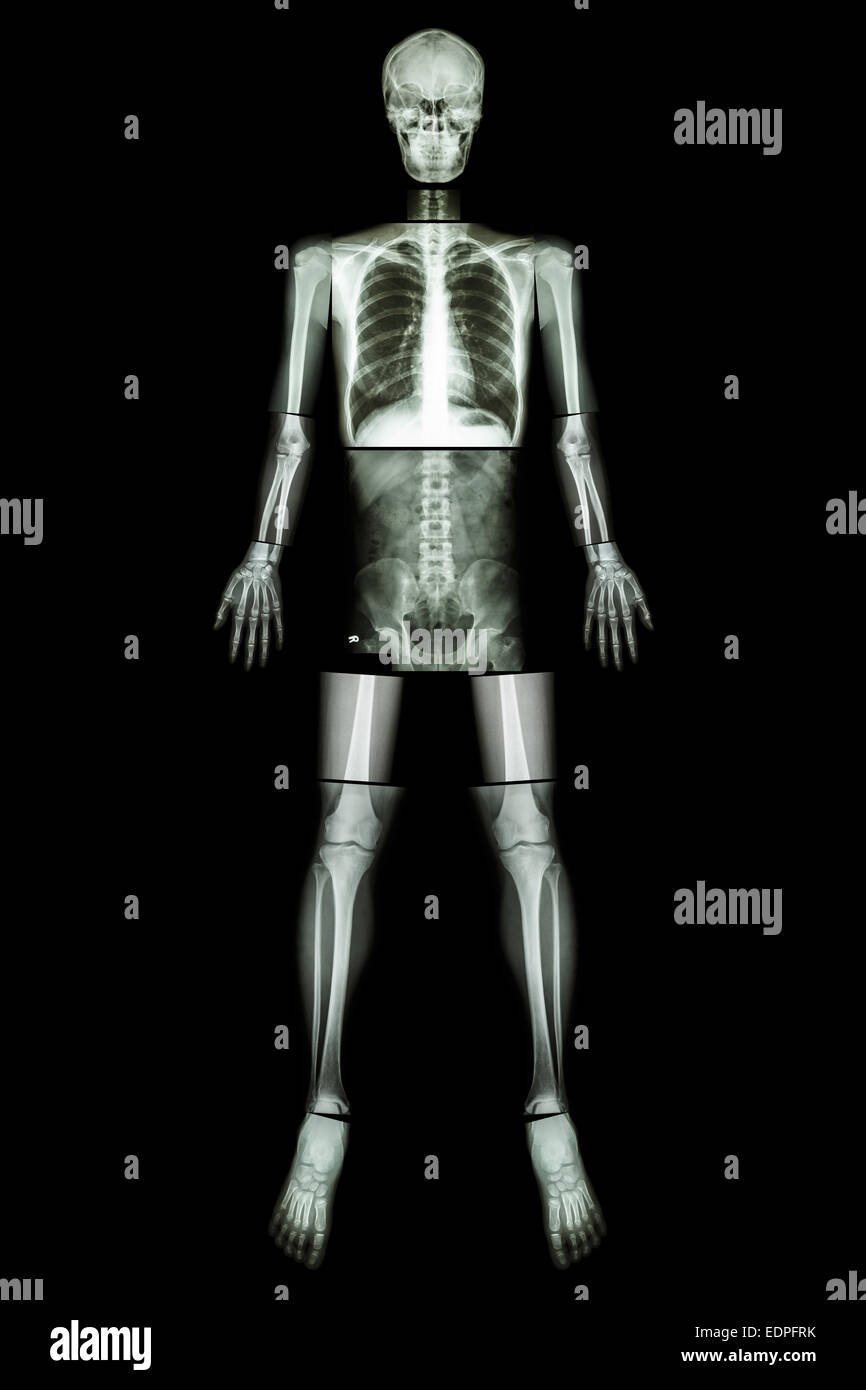 Posizione anatomica. (X-ray tutto il corpo : testa ,collo ,torace ,cuore ,polmone ,costola ,spalla ,scapola ,braccio ,avambraccio ,il gomito ,polso ,ha Foto Stock