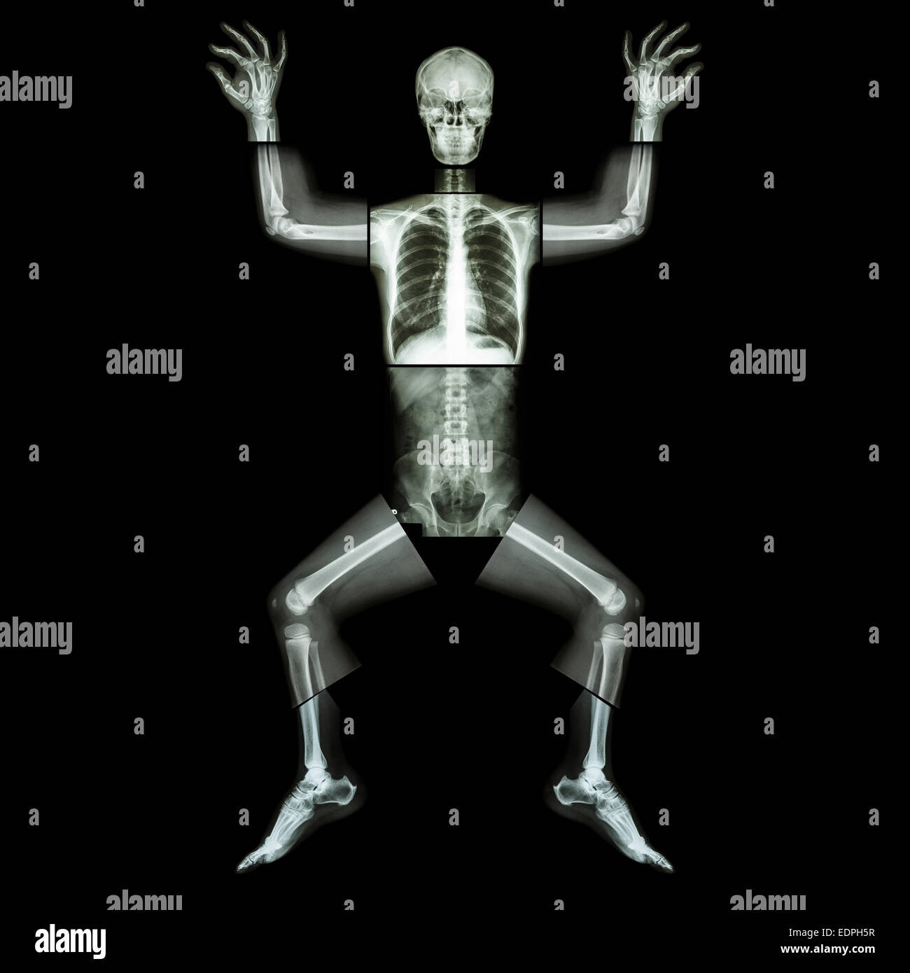 Jigsaw human x-ray ( intero corpo : cranio testa viso collo spalla della colonna vertebrale braccio del giunto a gomito avambraccio polso mano dito torace torace hea Foto Stock