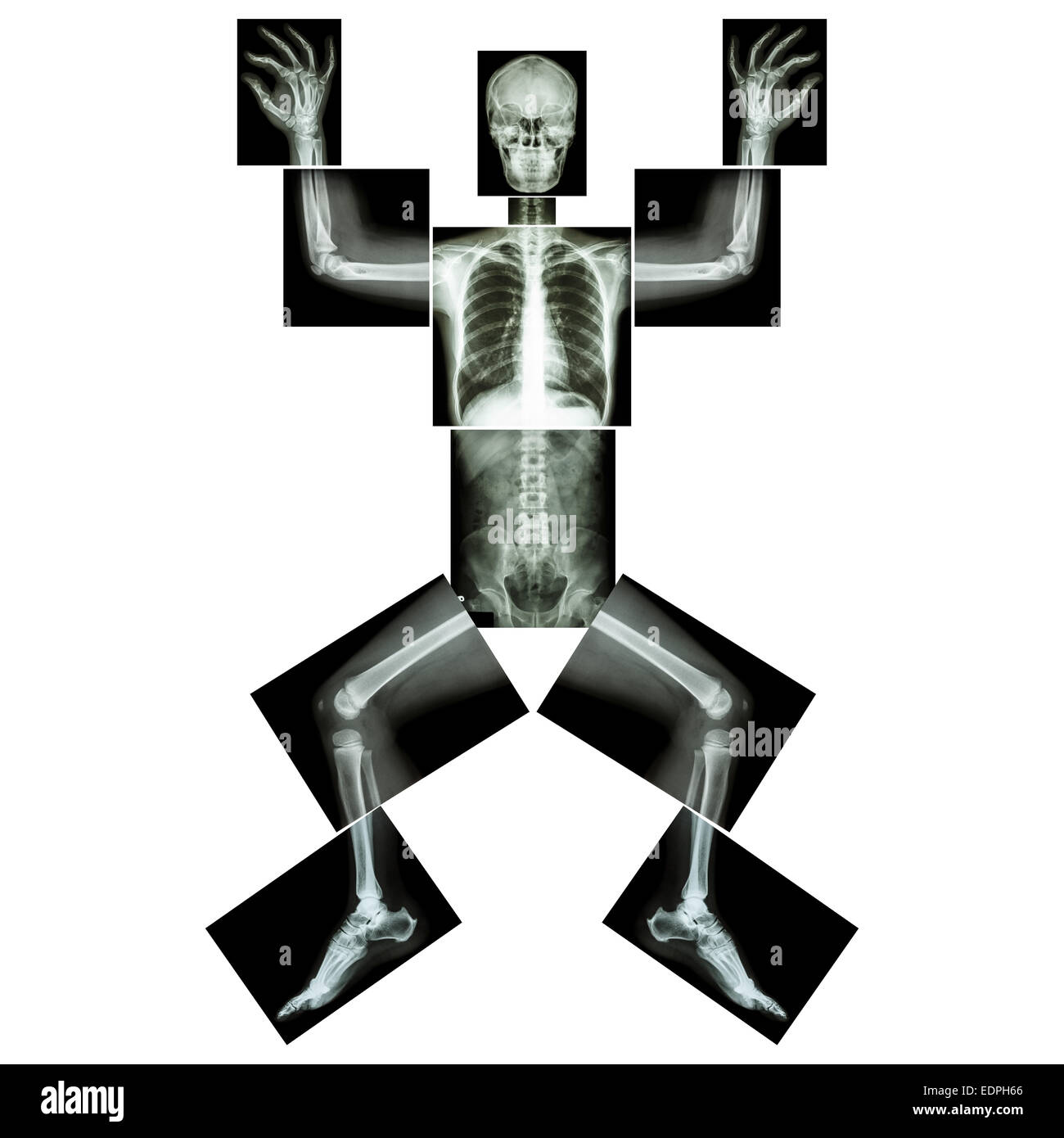 Jigsaw human x-ray ( intero corpo : cranio testa viso collo spalla della colonna vertebrale braccio del giunto a gomito avambraccio polso mano dito torace torace hea Foto Stock