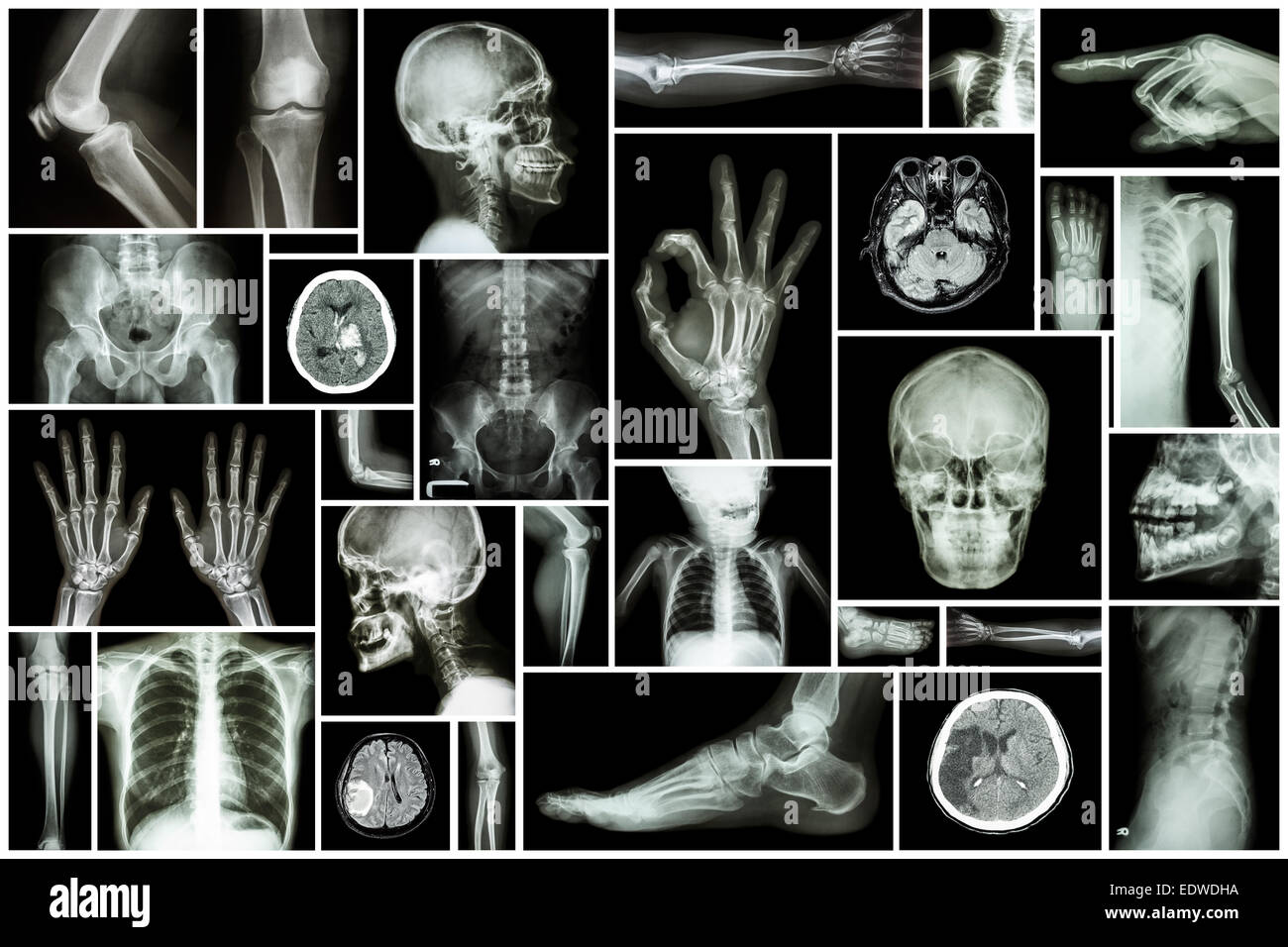 Collezione X-ray più parte dell'umana Foto Stock