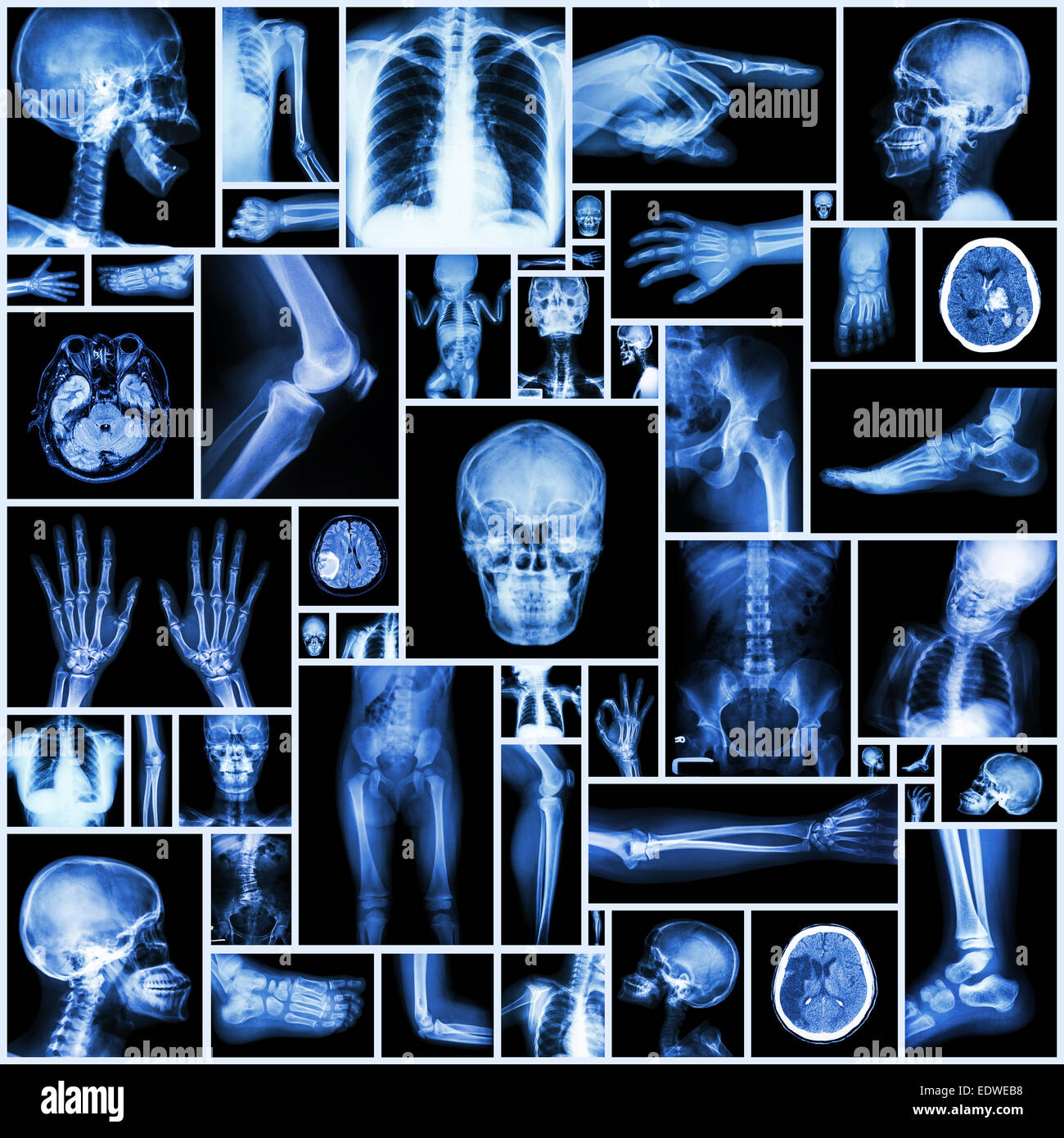 Collezione X-ray più parte dell'umana Foto Stock