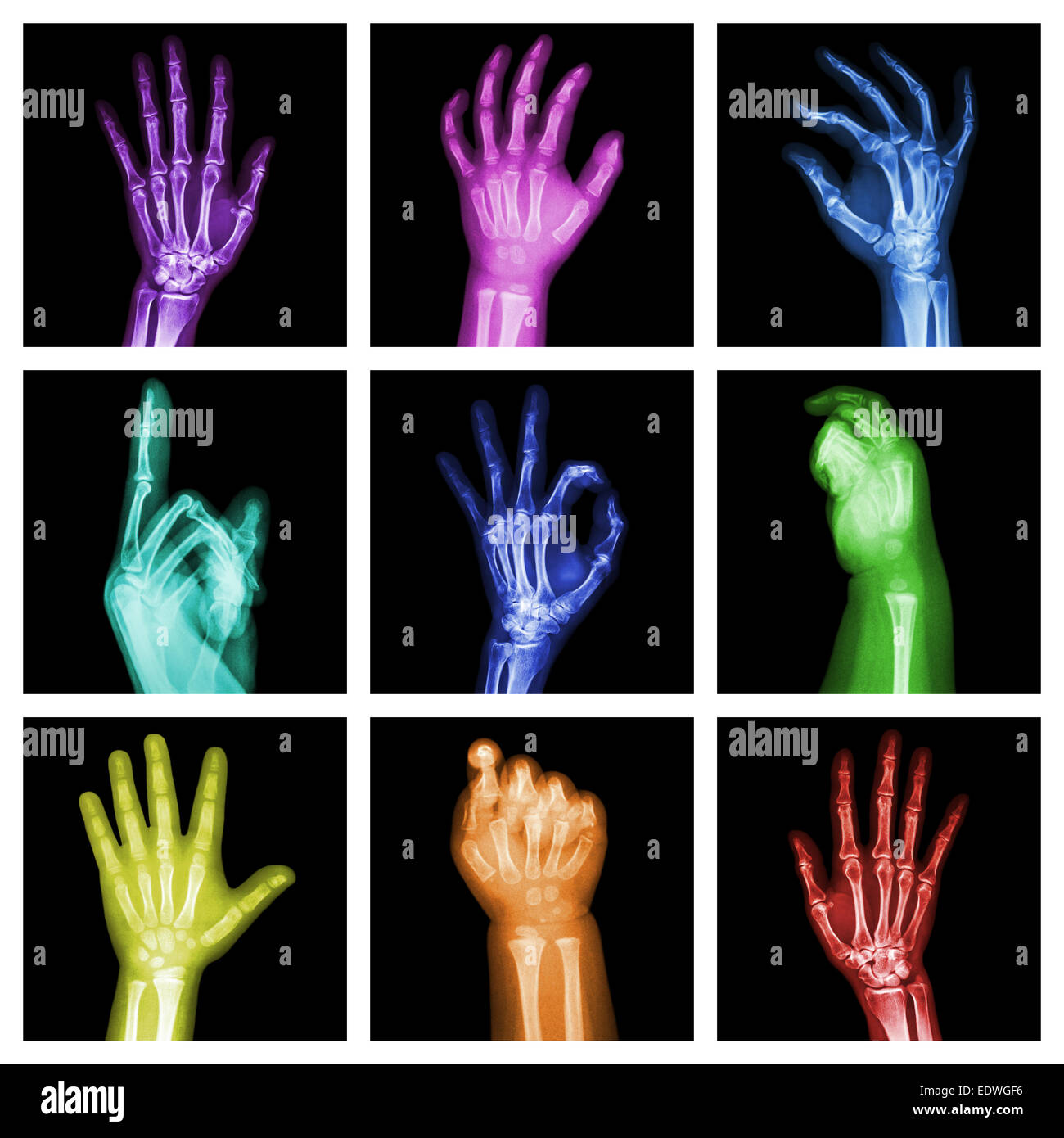 Collezione di coloratissimi x-ray mani Foto Stock