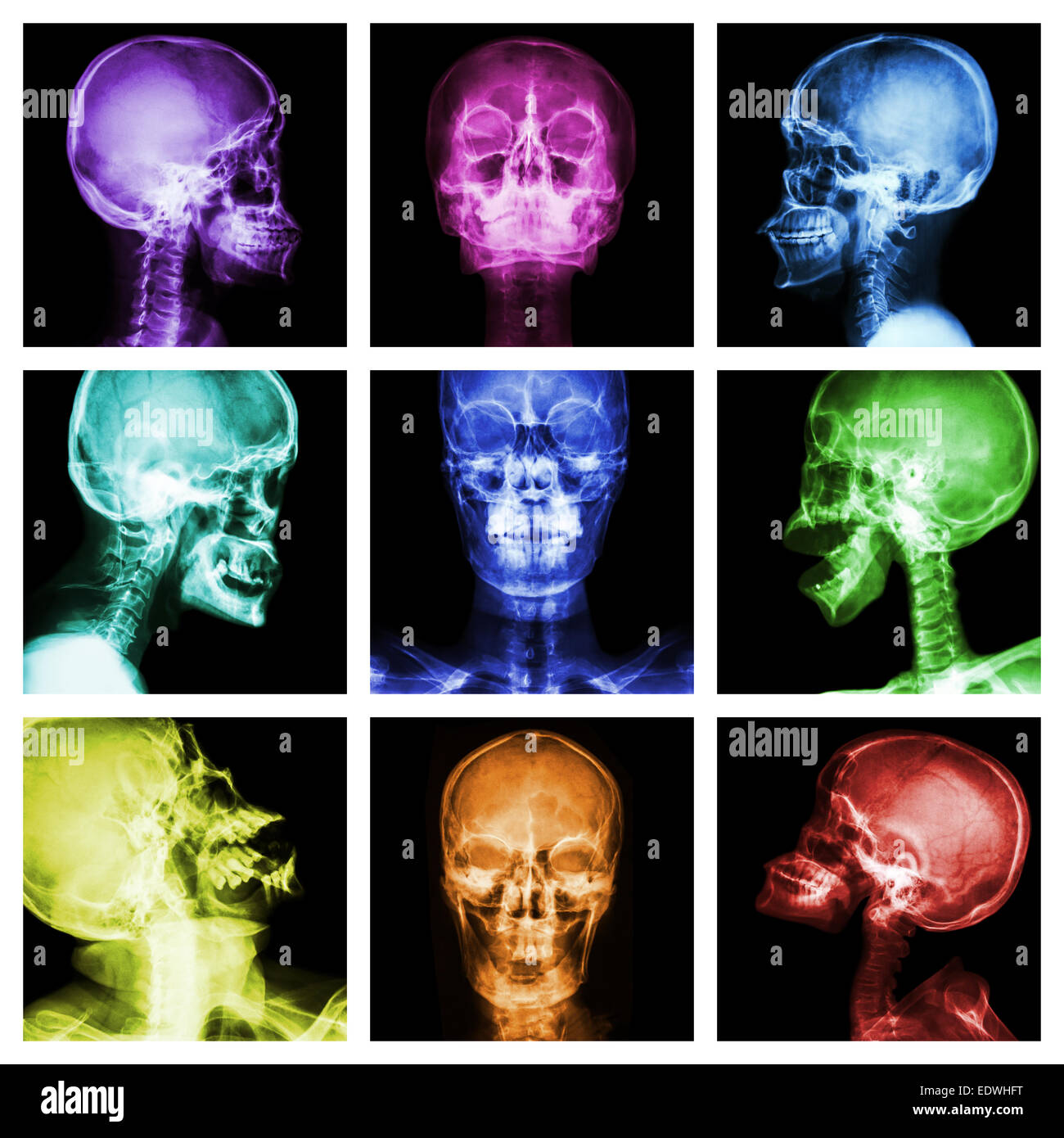 Raccolta di cranio asiatica Foto Stock