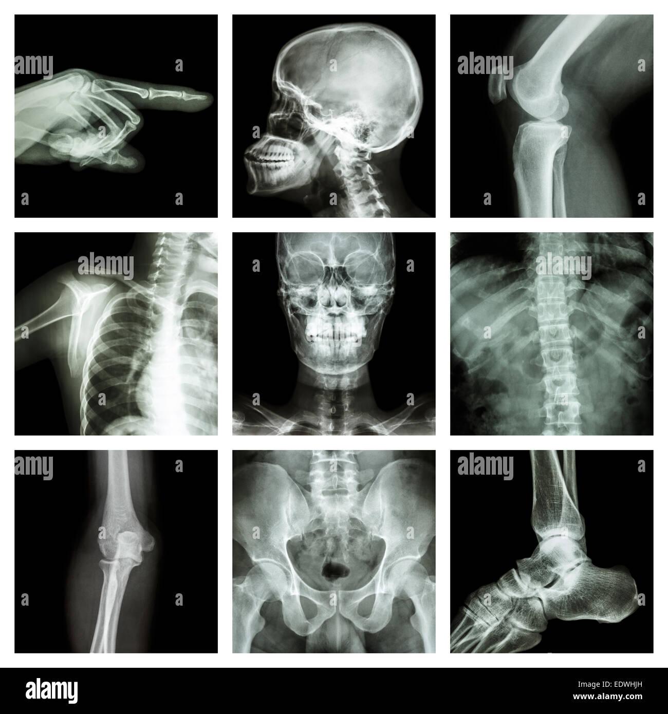 Collezione X-ray parte dell'umana Foto Stock