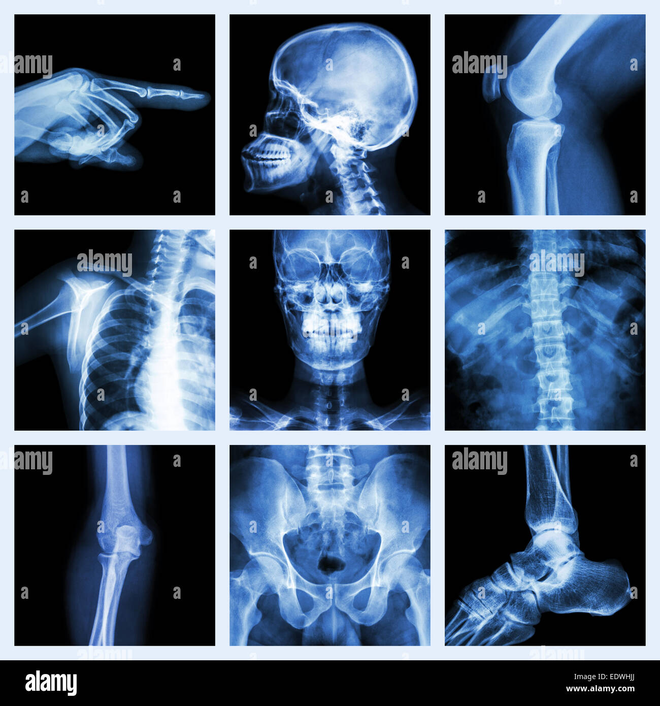 Collezione X-ray parte dell'umana Foto Stock
