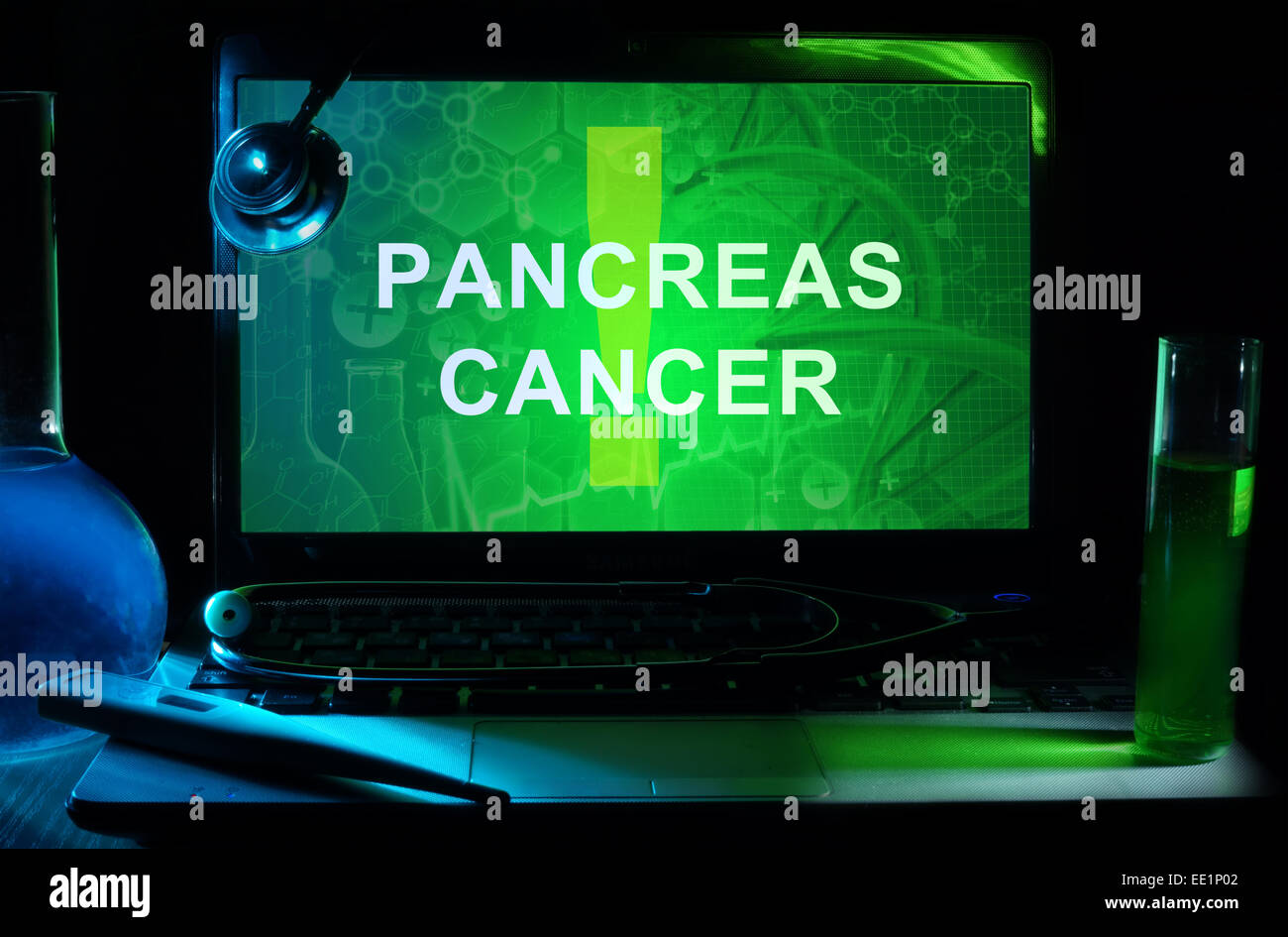 Notebook con parole di cancro del pancreas, provette e stetoscopio Foto Stock