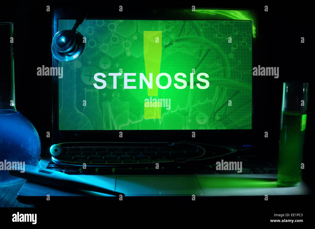 Notebook con parole stenosi, provette e stetoscopio Foto Stock