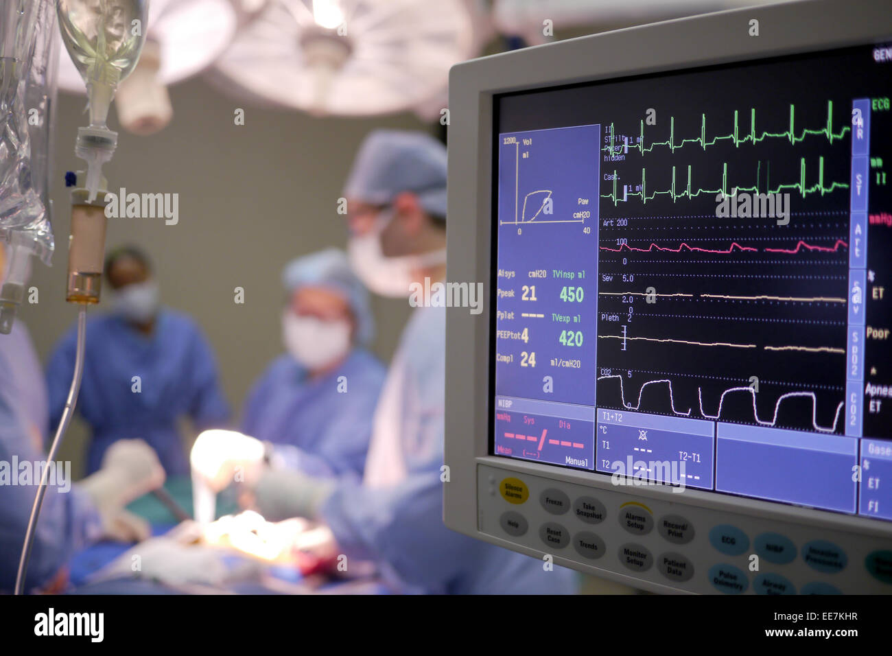 Monitor di cuore e di gocciolamento di soluzione salina Foto Stock