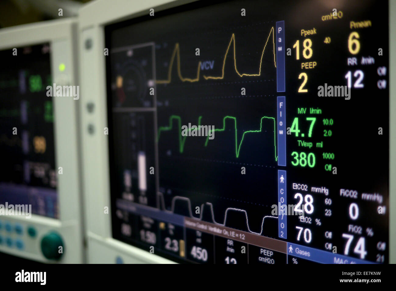 Dettaglio del monitor per la frequenza cardiaca Foto Stock