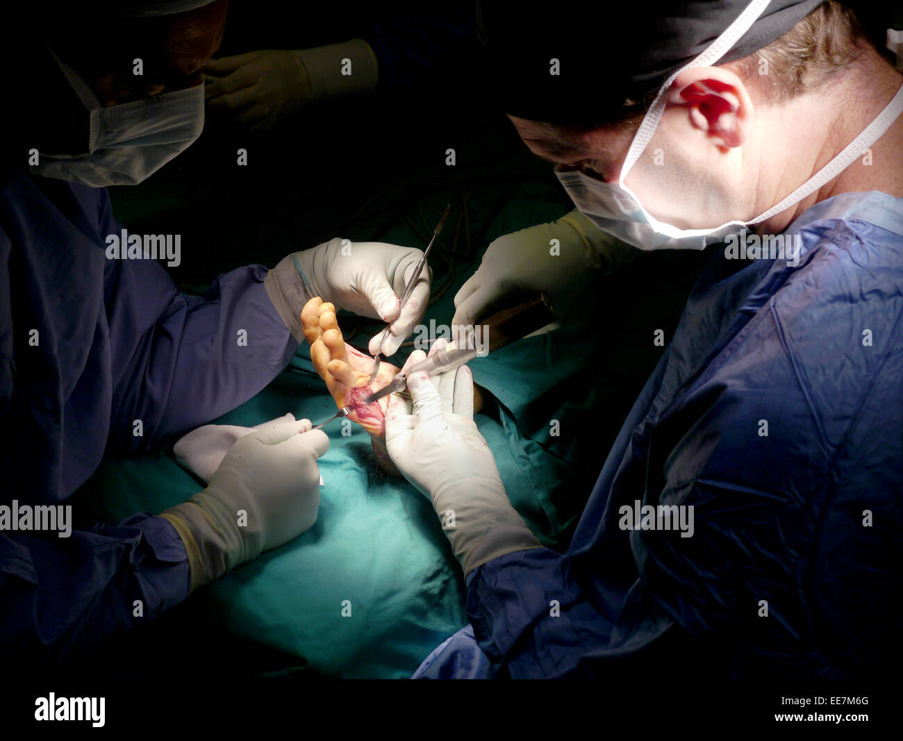 La chirurgia in ospedale ER Foto Stock