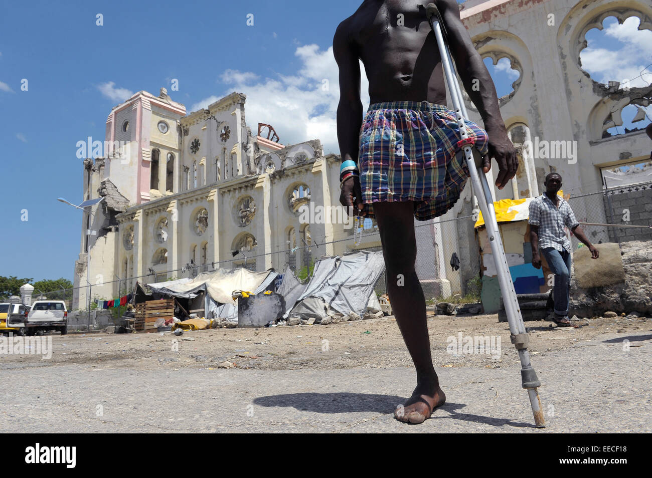 Icaro, che ha perso la sua gamba in occasione del terremoto di cinque anni fa, ancora vive in una tenda al di fuori della rovina di Port-au-Prince's compressione Foto Stock