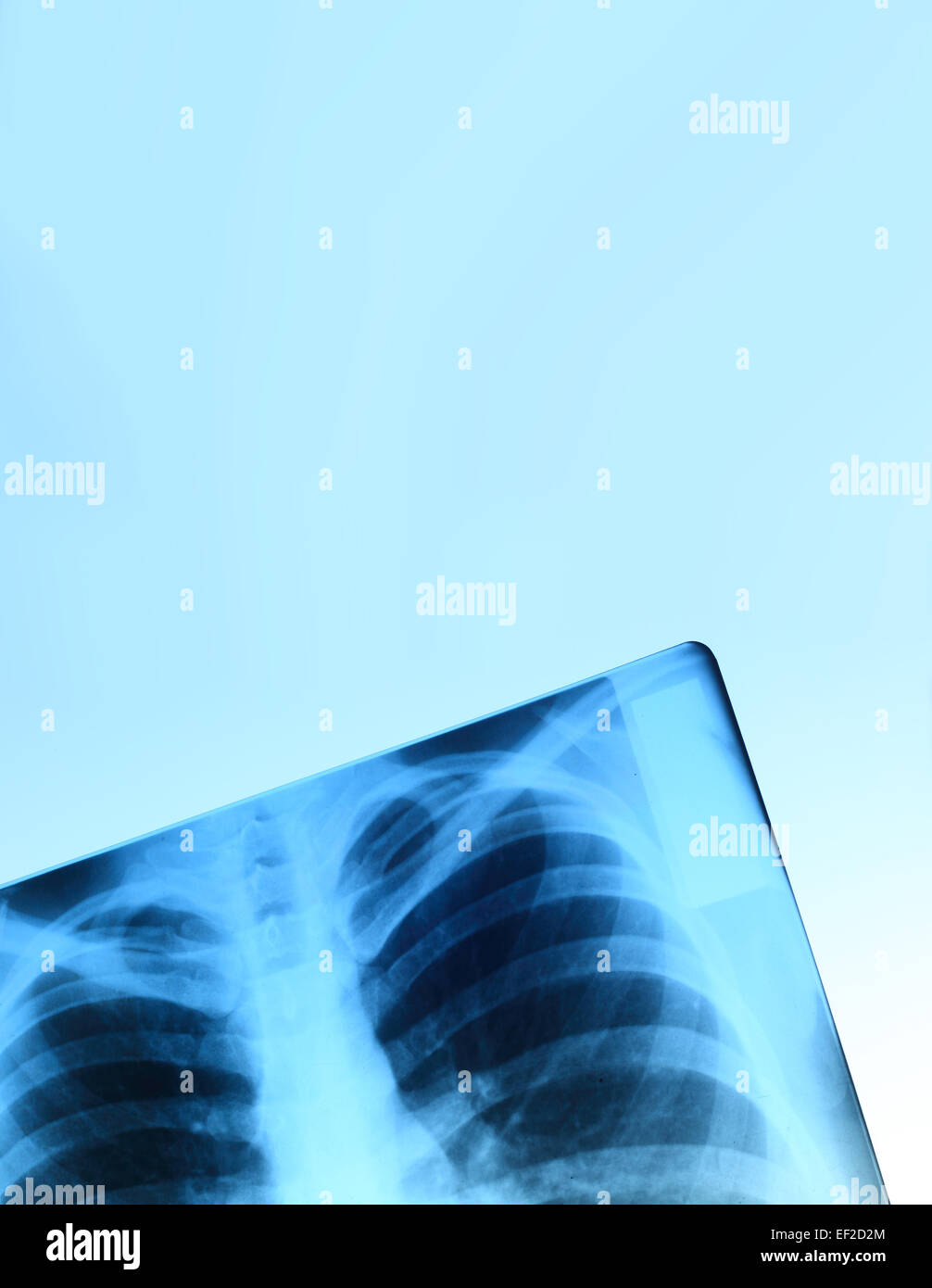 Immagine a raggi X del torace ossa di adulto, astratto sfondo blu Foto Stock