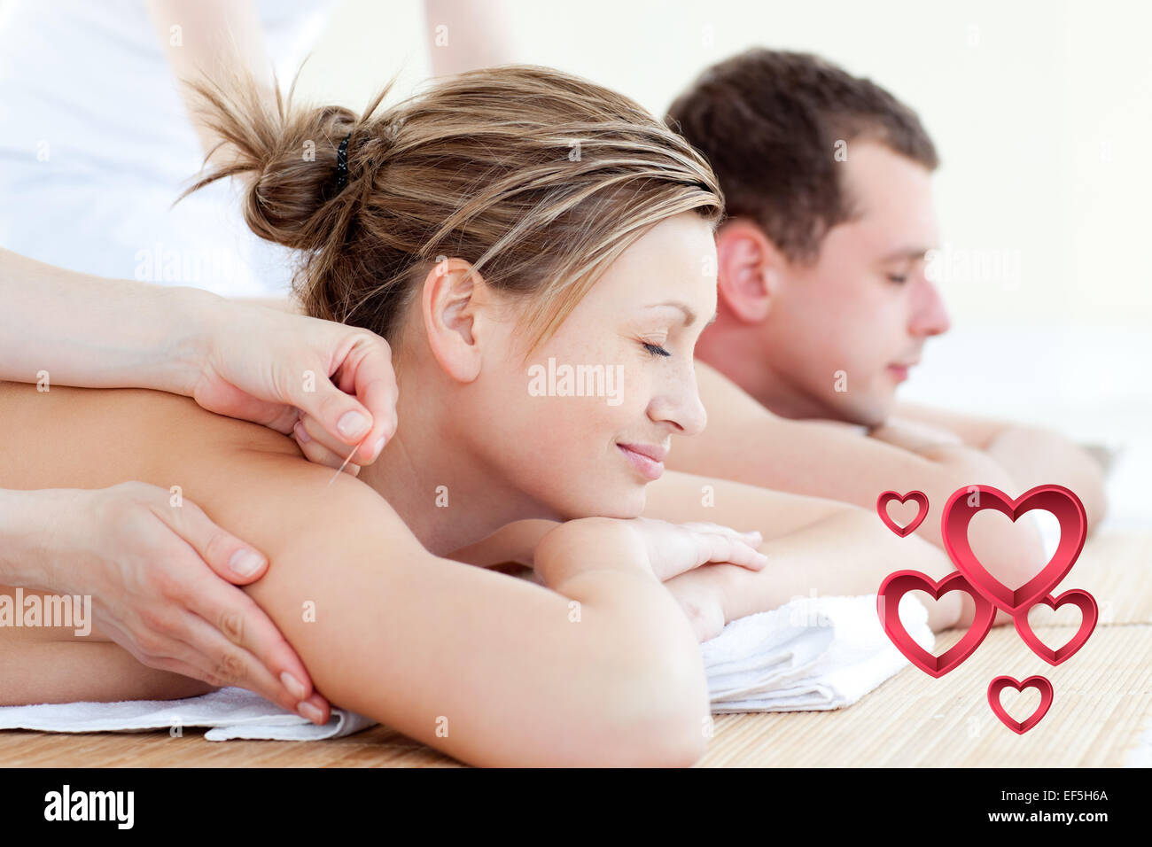 Immagine composita di amare giovane avente una terapia acupunctre Foto Stock