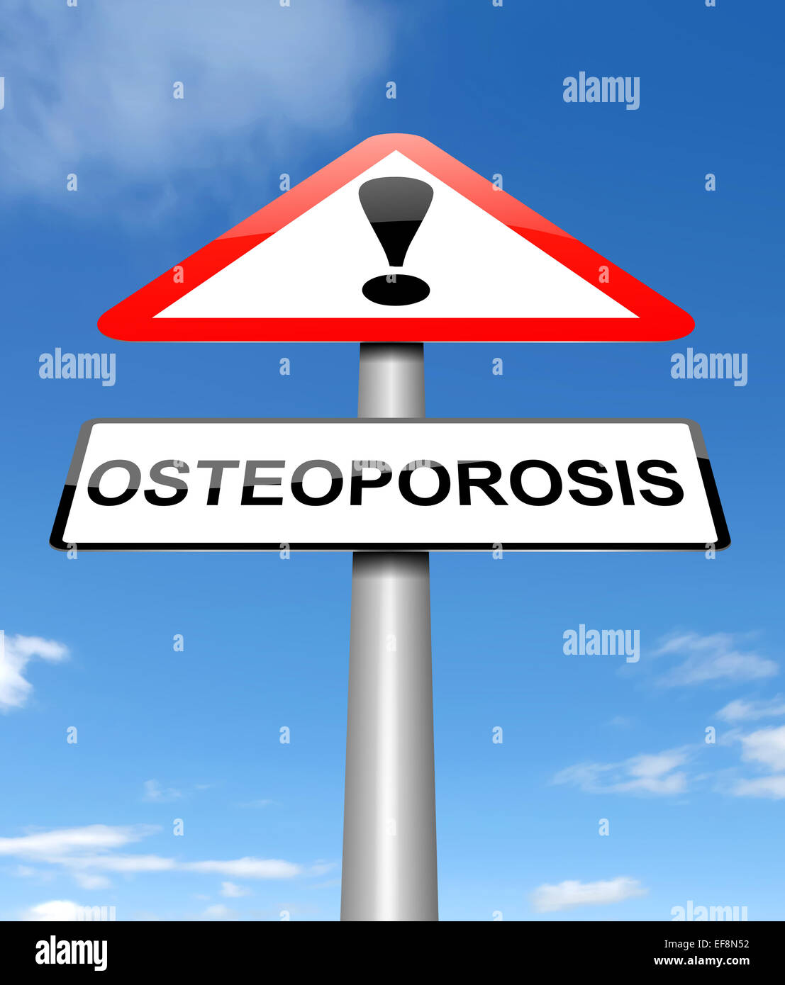 Il concetto di osteoporosi. Foto Stock