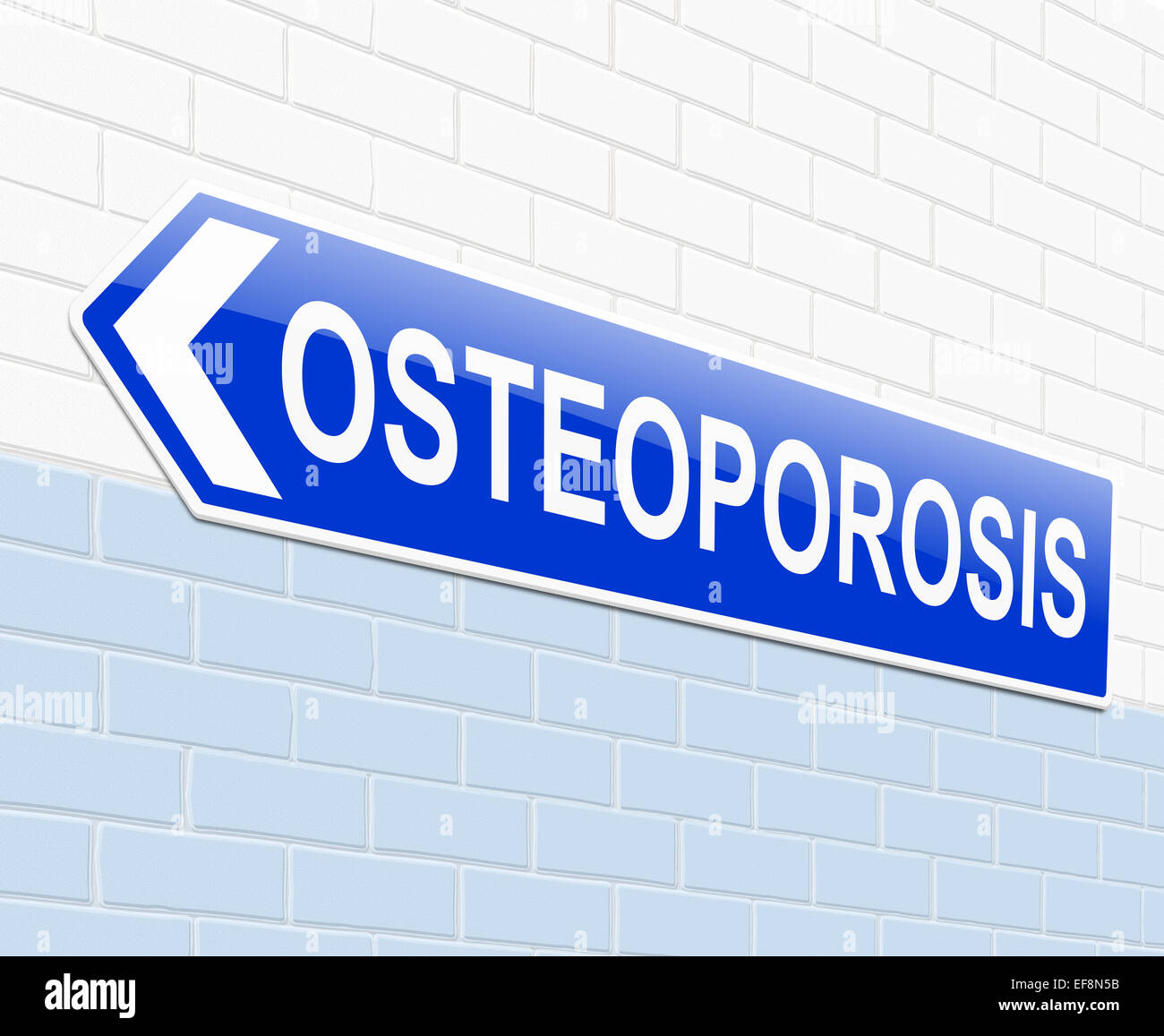 Il concetto di osteoporosi. Foto Stock