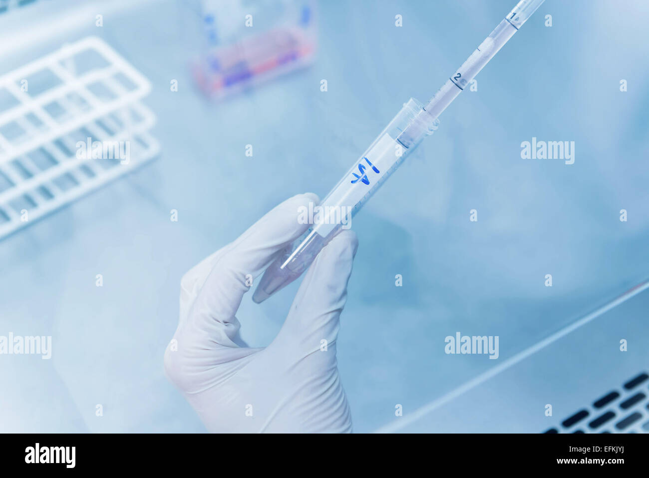 Cancer Research Laboratory di mani di scienziato maschio celle di erogazione con una pipetta elettronica Foto Stock