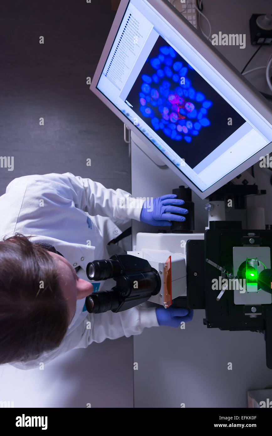 Cancer Research Laboratory, vista aerea della donna scienziato studiando le cellule del cancro sotto il microscopio elettronico Foto Stock