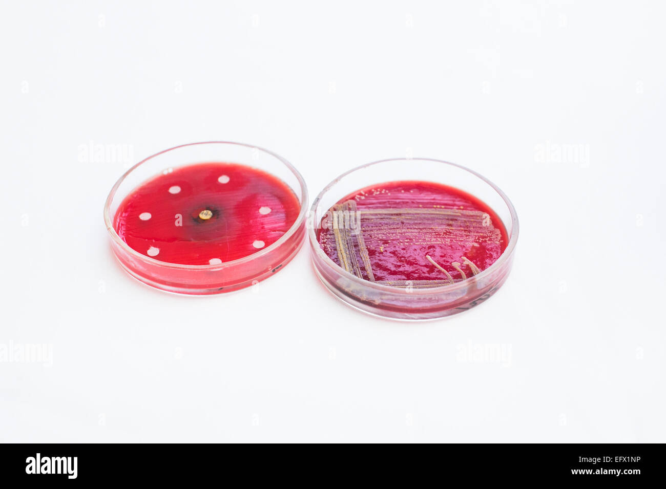 Due capsule di Petri con batteri che crescono in loro Foto Stock