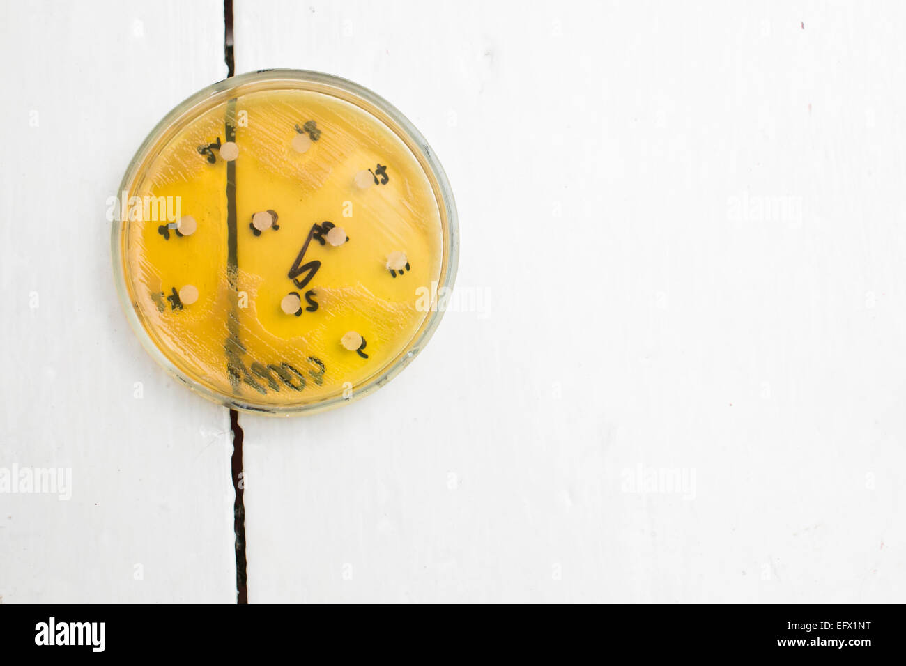 Piastra di petri con la crescita dei batteri in essa Foto Stock