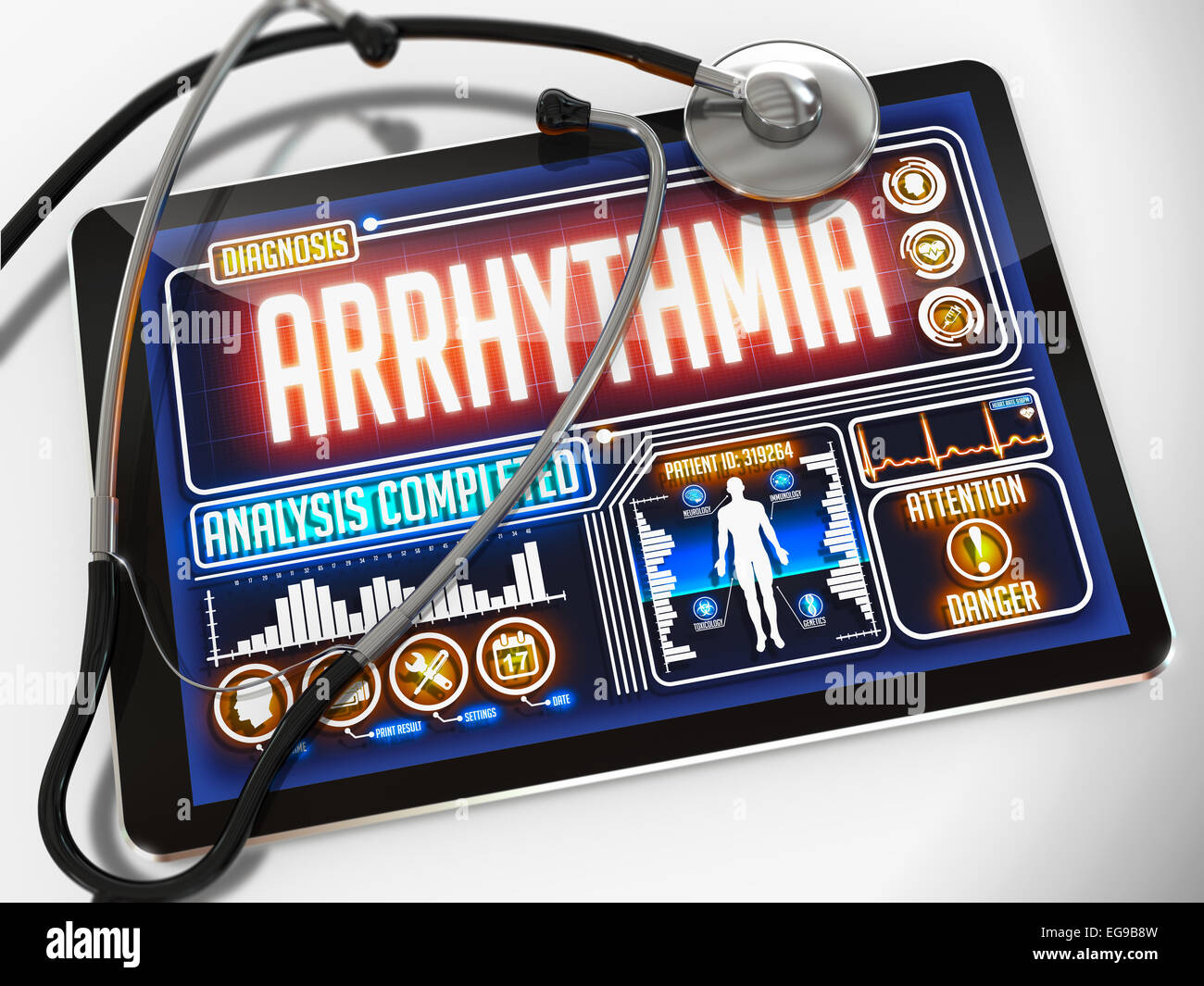 L'aritmia- diagnosi sul display del Tablet medico e un stetoscopio nero su sfondo bianco. Foto Stock