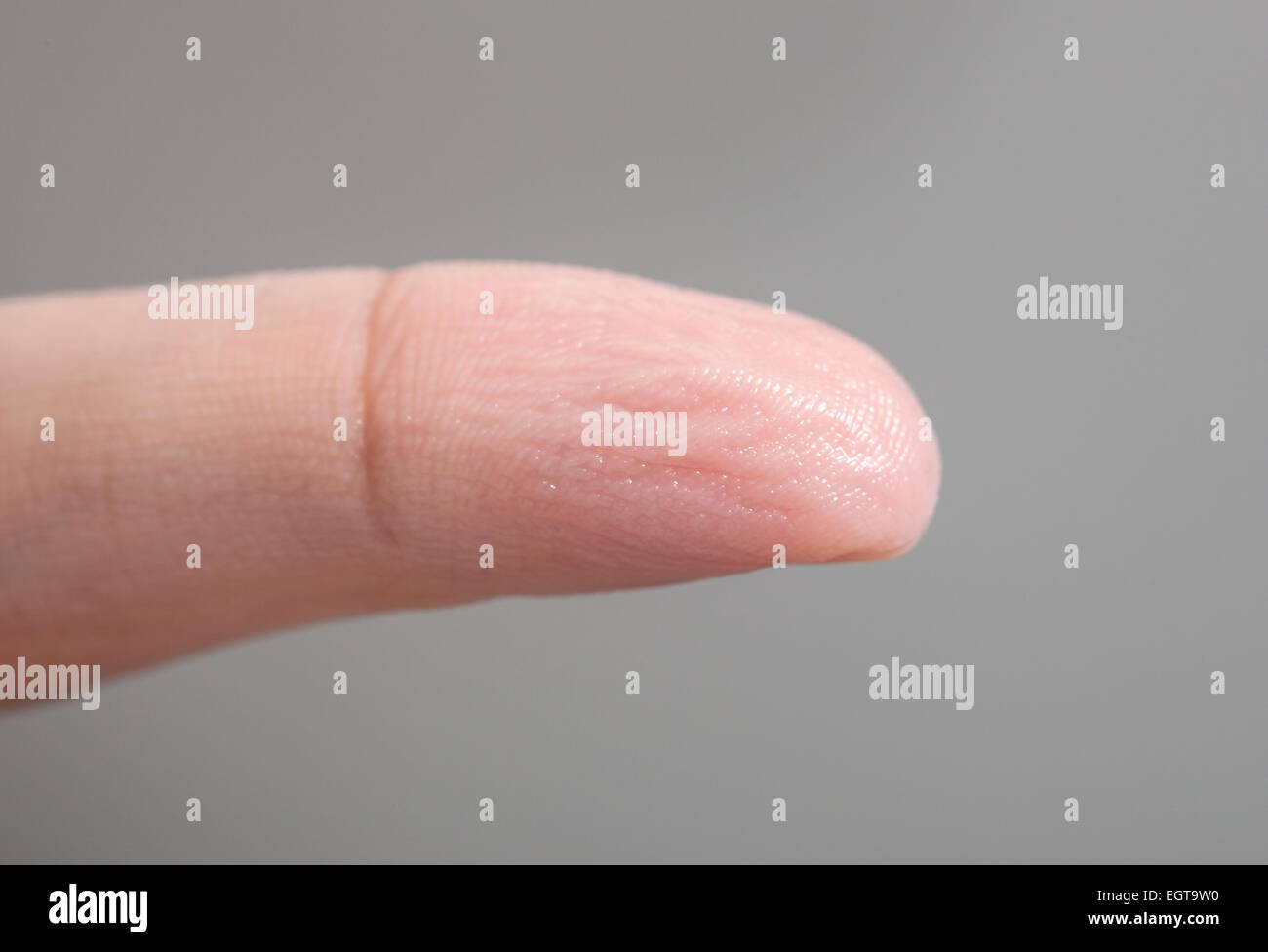 Pelle rugosa di un dito della mano a causa del lungo periodo di tempo in acqua. Foto Stock