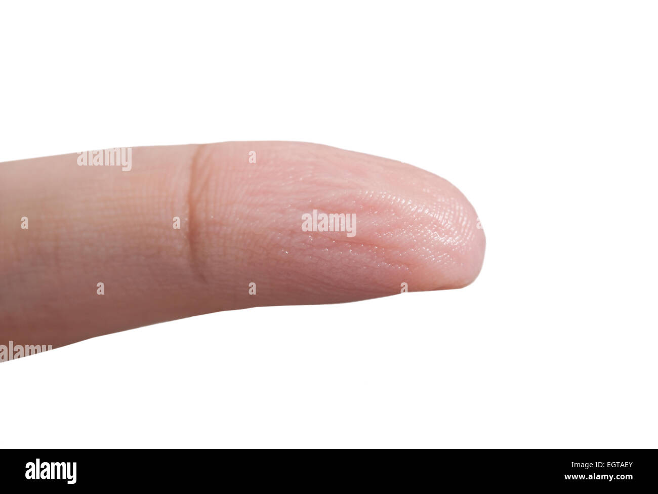 Pelle rugosa di un dito della mano a causa del lungo periodo di tempo in acqua. Foto Stock