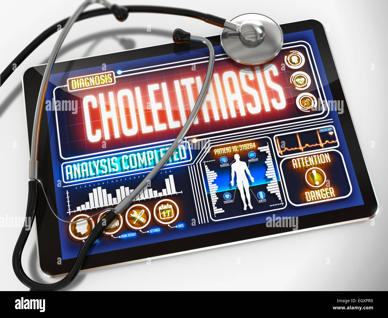 Colelitiasi sul display del Medical Tablet. Foto Stock