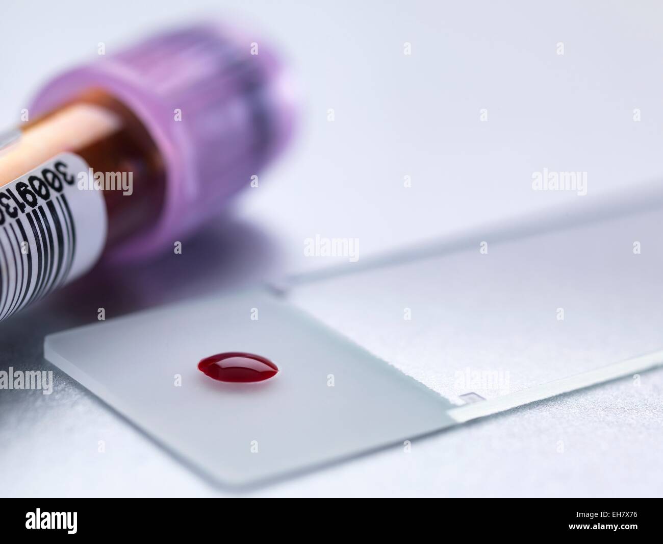 Analisi del sangue Foto Stock